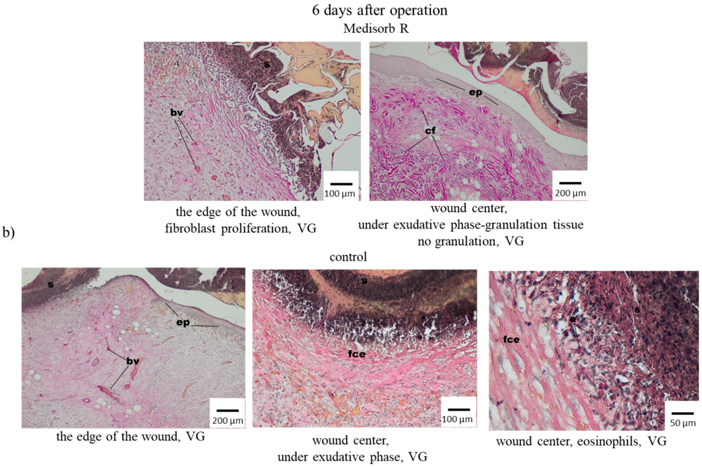 Materials 12 00970 g008b