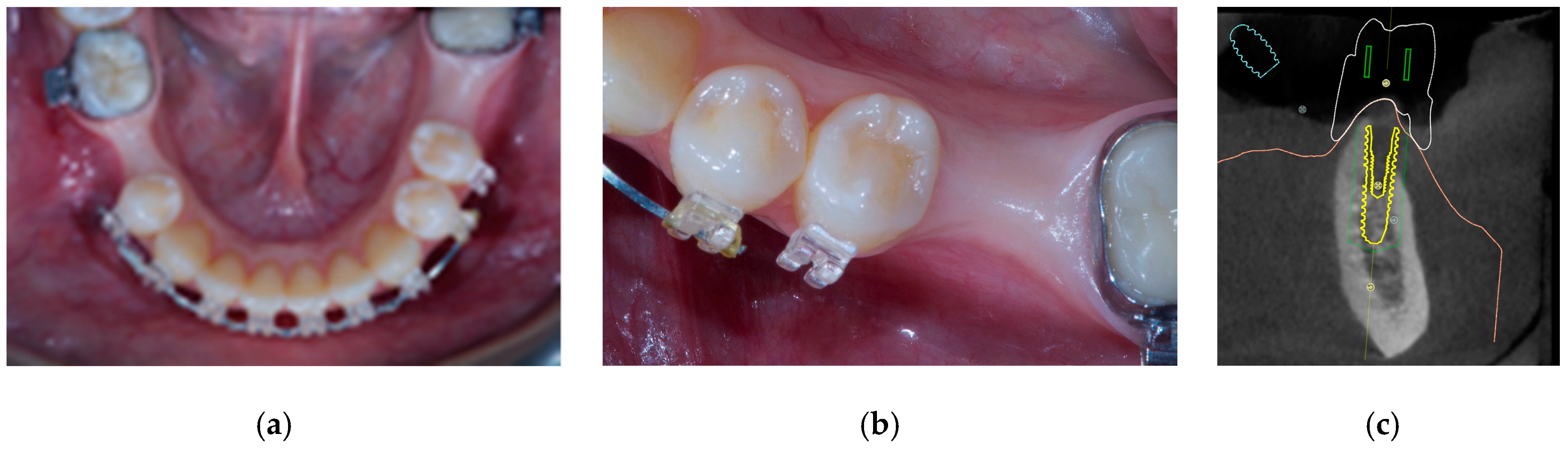 Materials 12 01710 g001