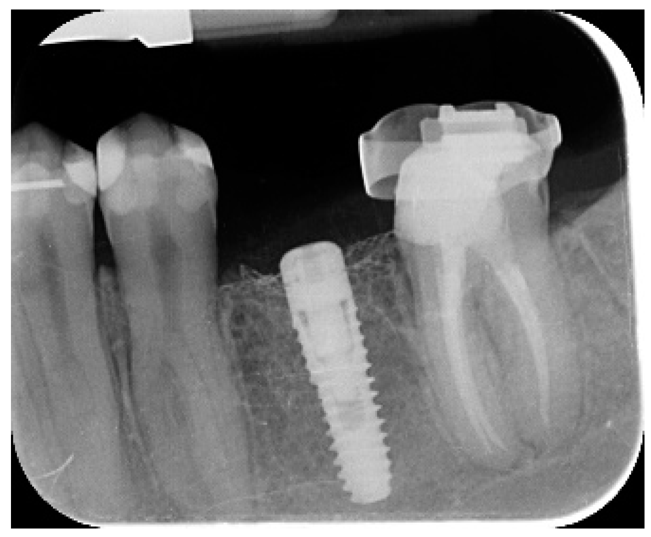 Materials 12 01710 g003