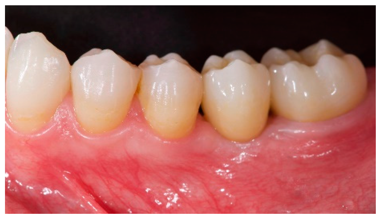 Materials 12 01710 g005