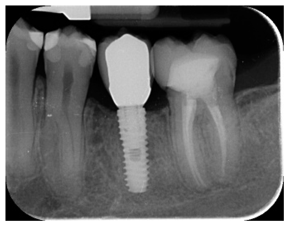 Materials 12 01710 g006