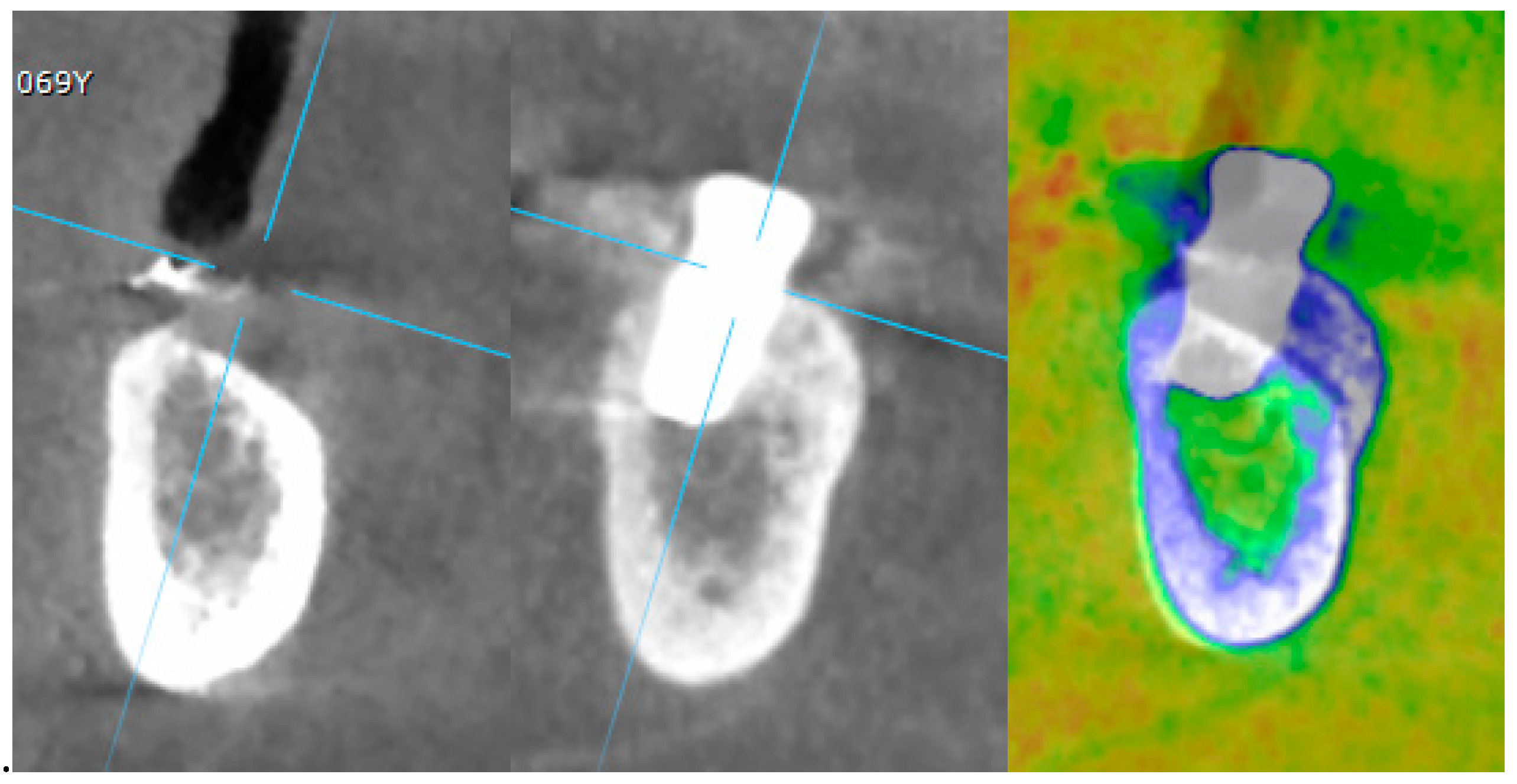 Materials 12 01710 g009