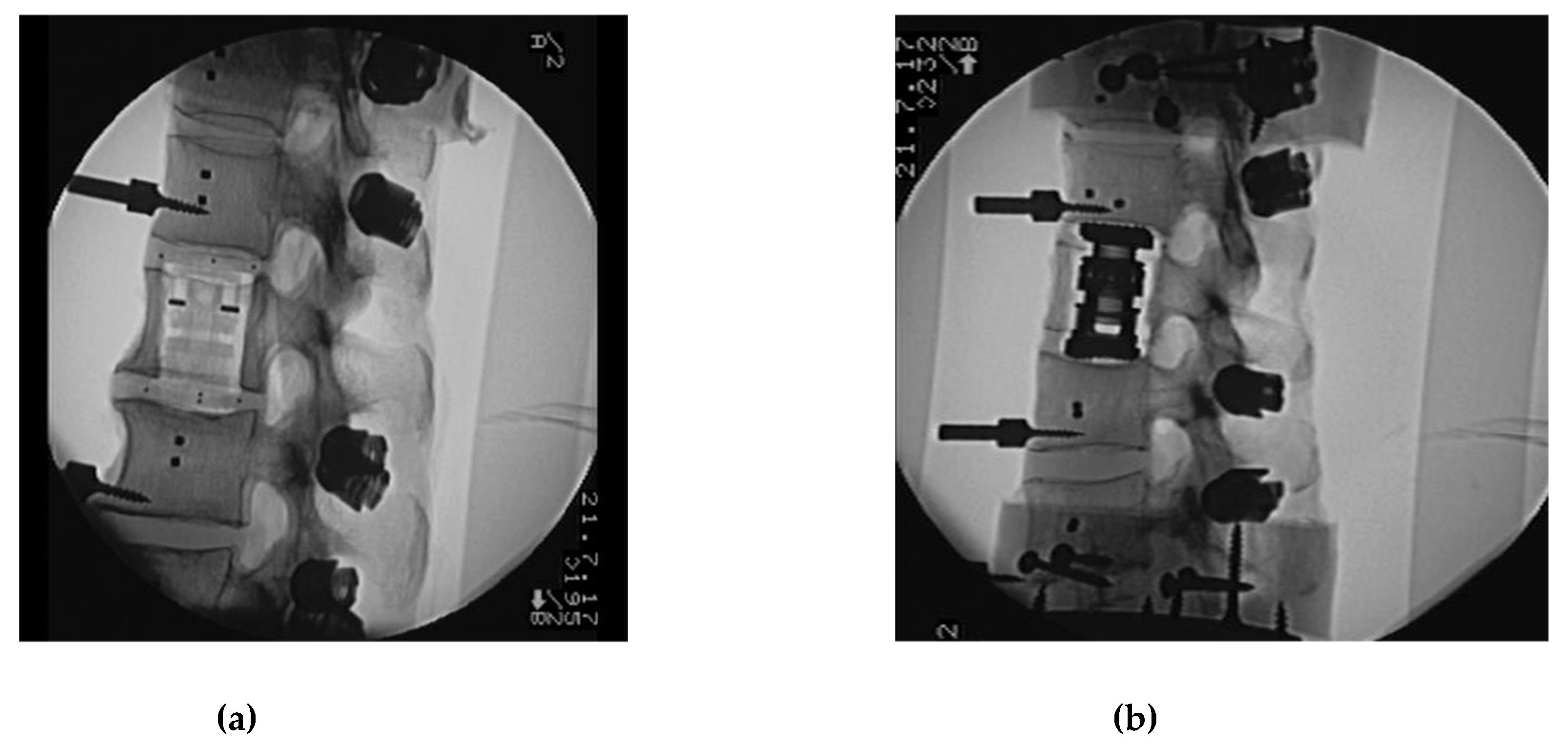 Materials 12 02732 g004