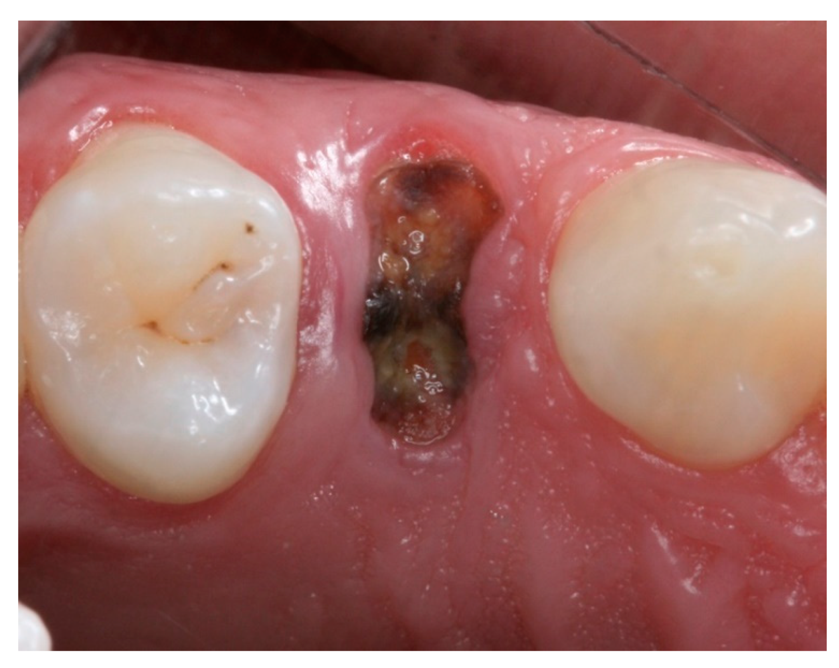 Materials 12 02902 g002