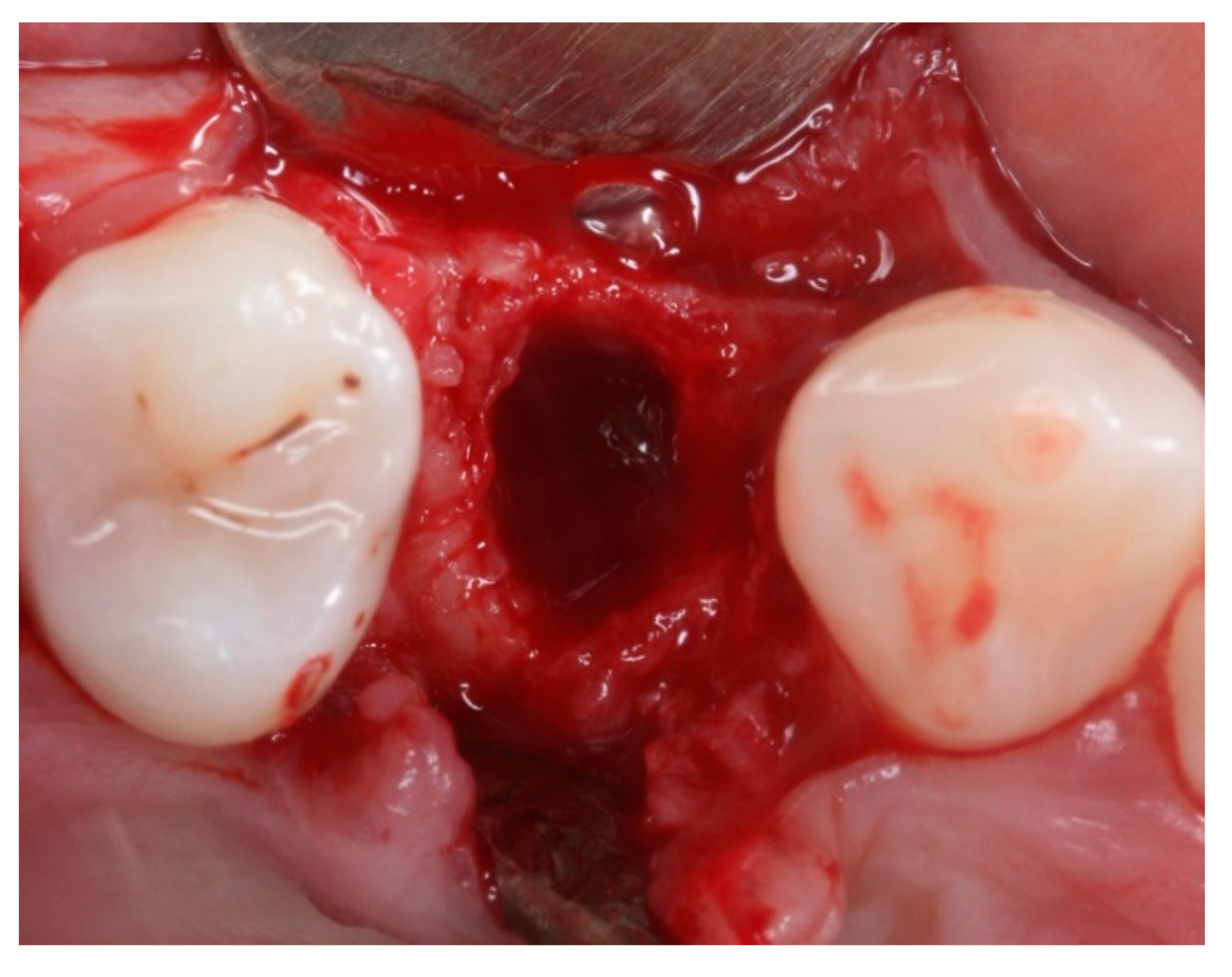 Materials 12 02902 g003