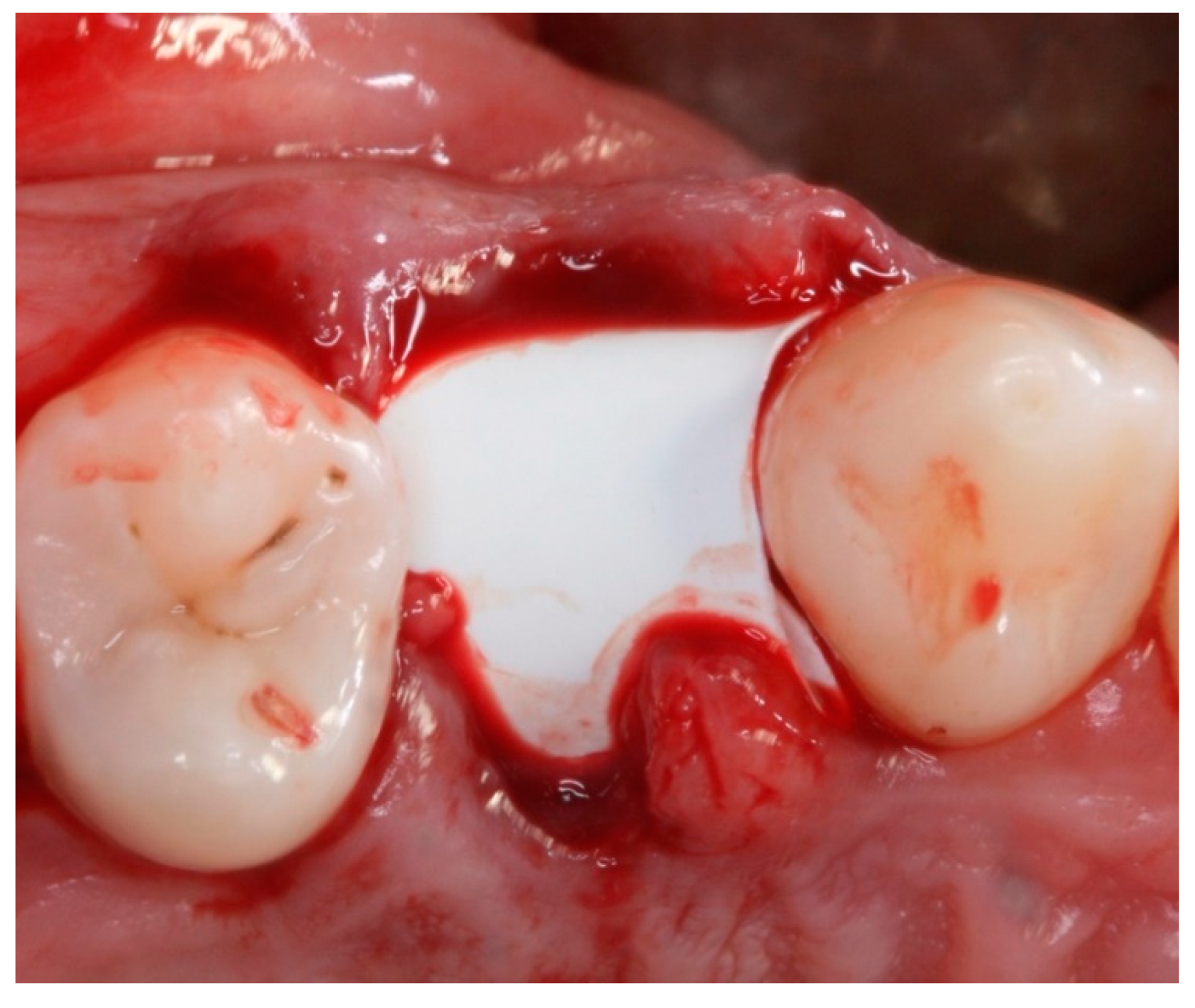 Materials 12 02902 g004