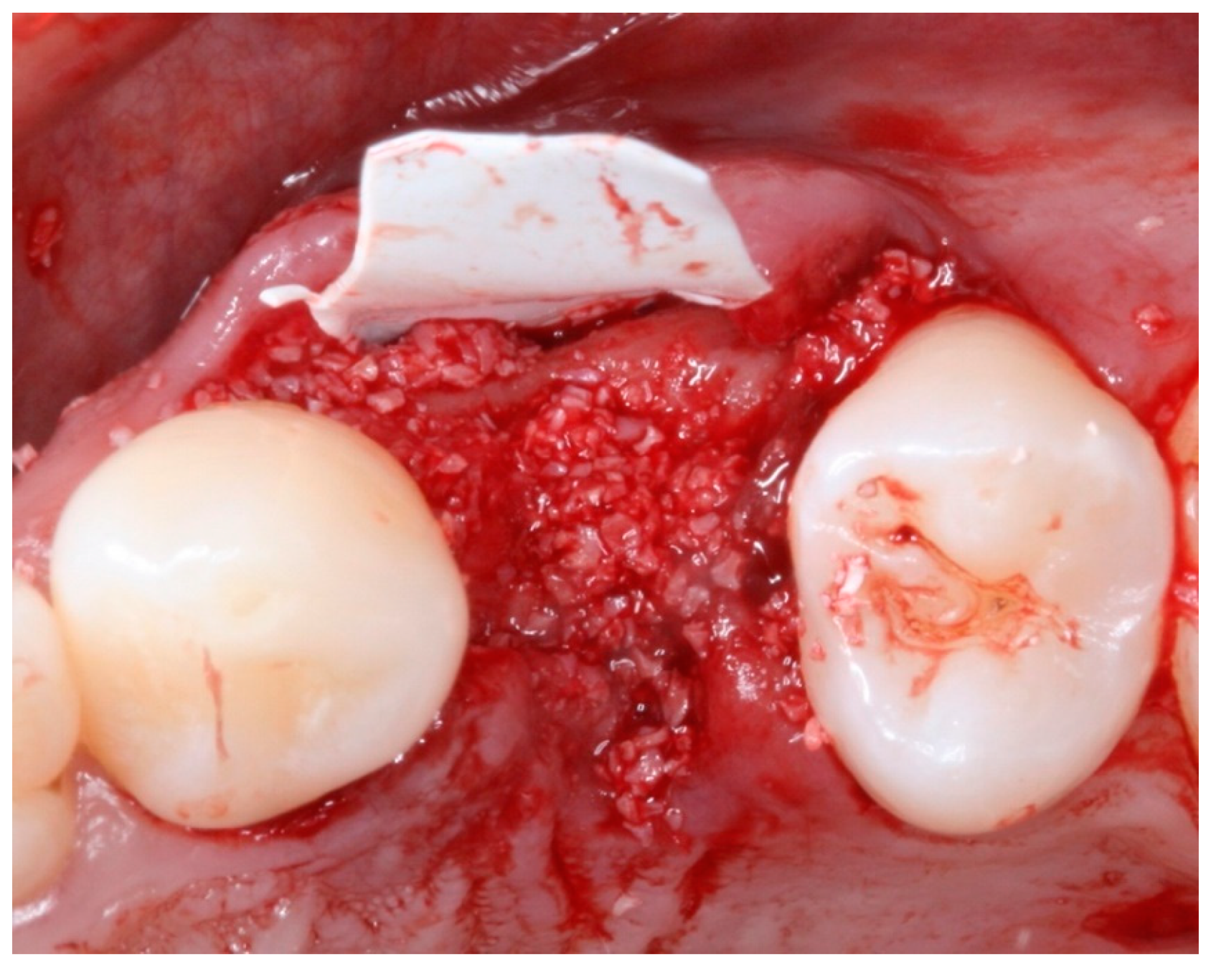 Materials 12 02902 g008