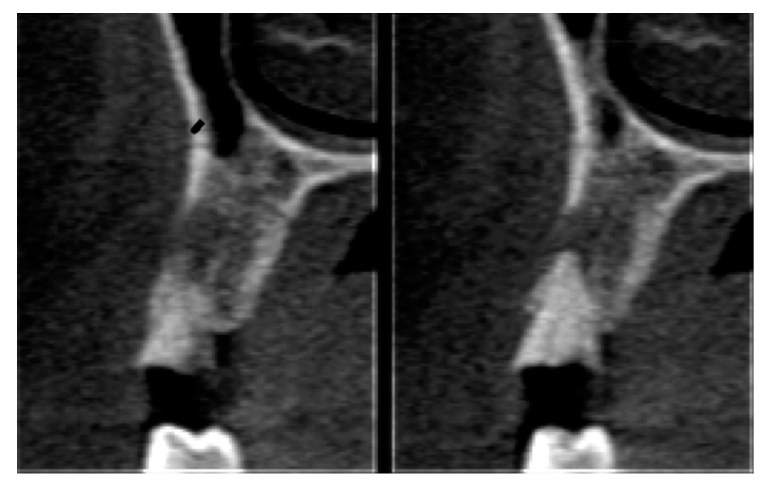 Materials 12 02902 g010