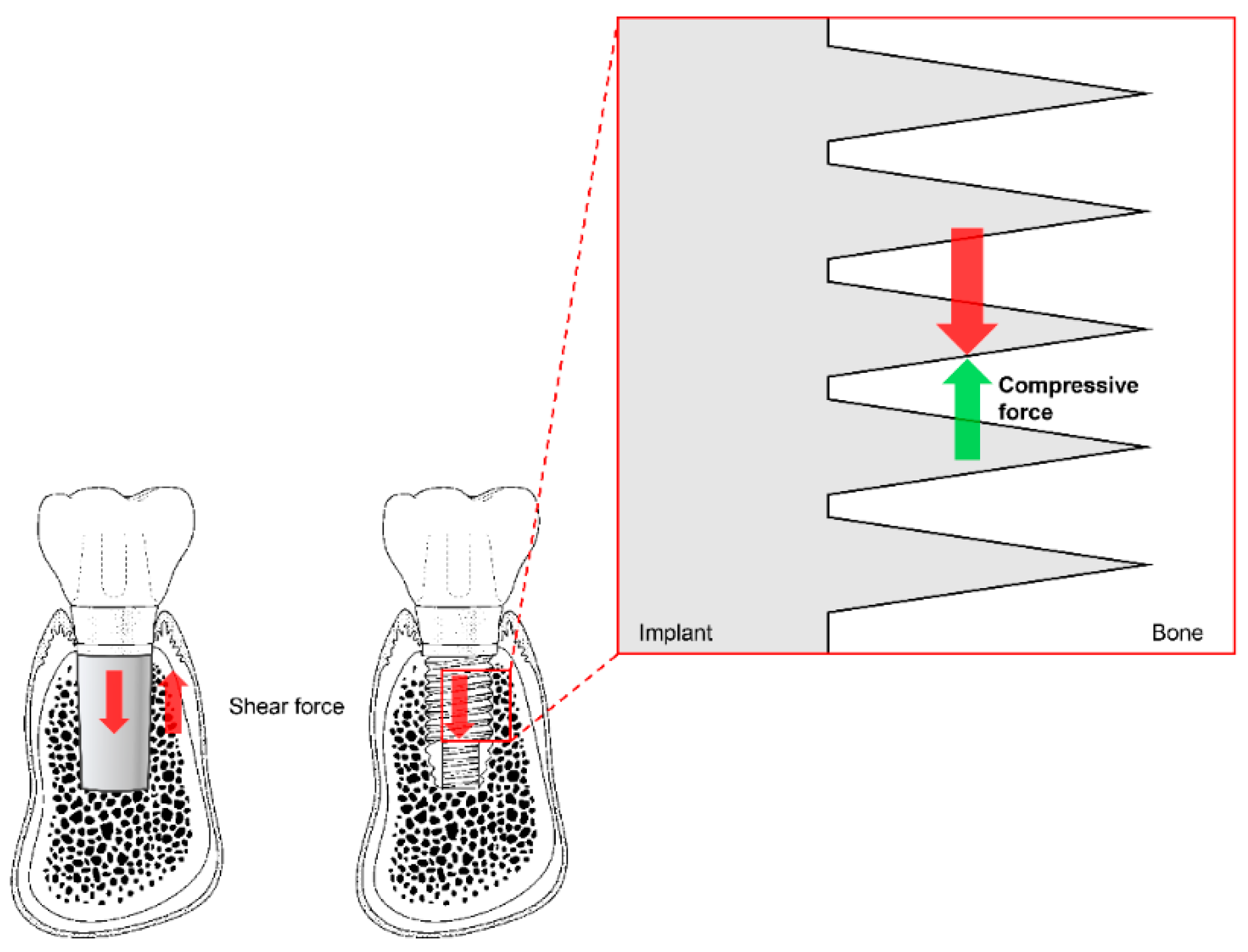 Materials 13 00072 g005