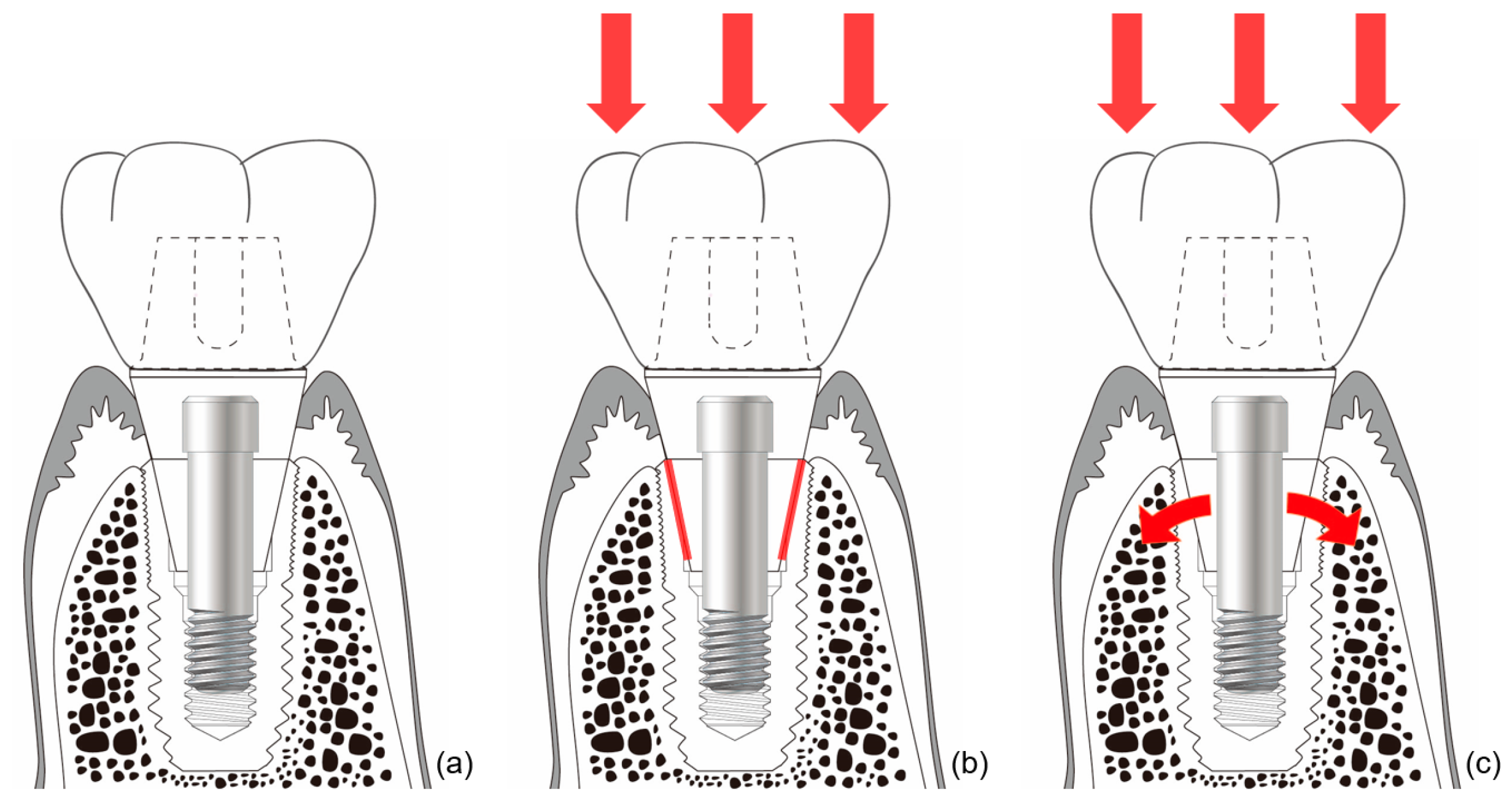 Materials 13 00072 g006