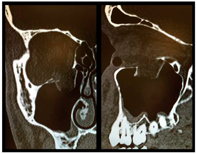 Materials 13 00206 g002