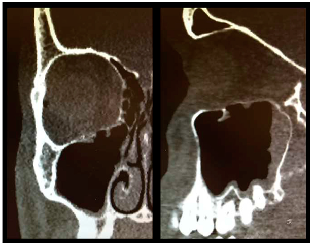 Materials 13 00206 g003