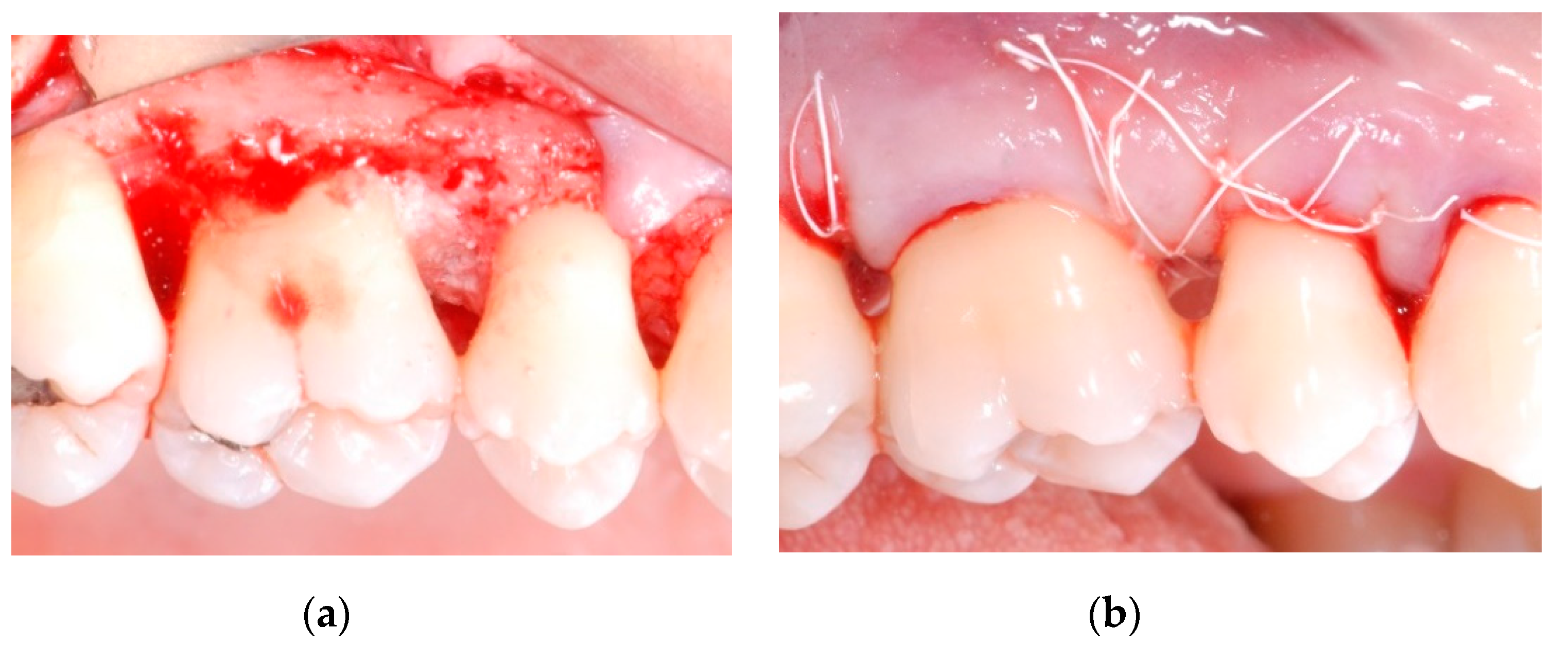 Materials 13 00269 g002