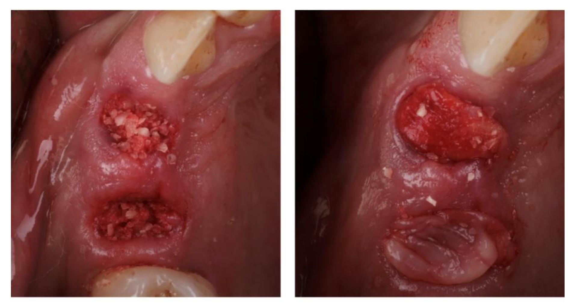 Materials 13 01083 g001