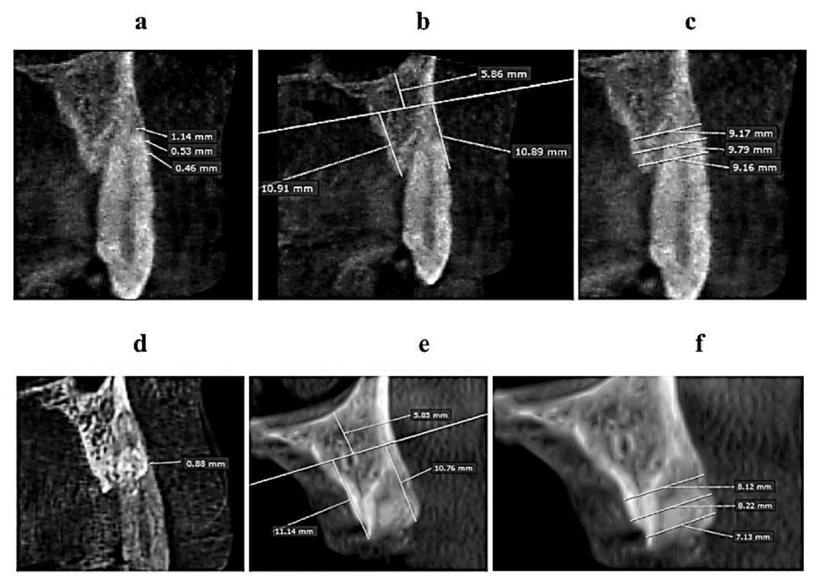 Materials 13 01083 g003