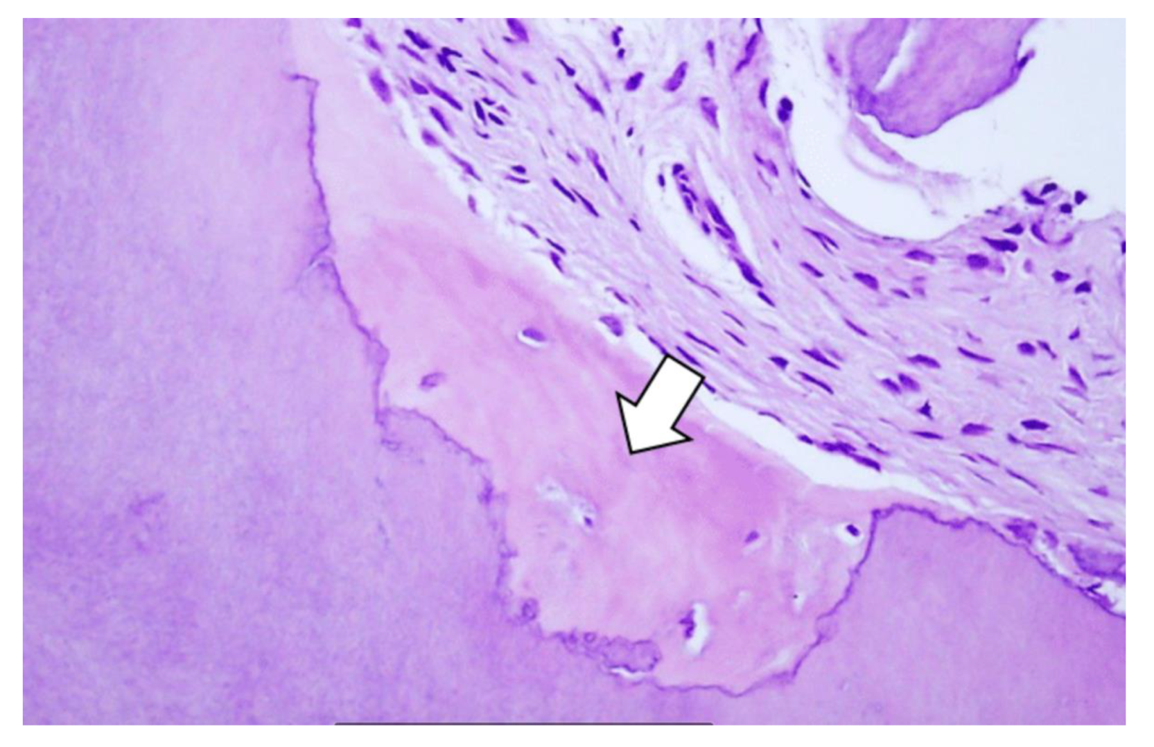 Materials 13 01083 g005