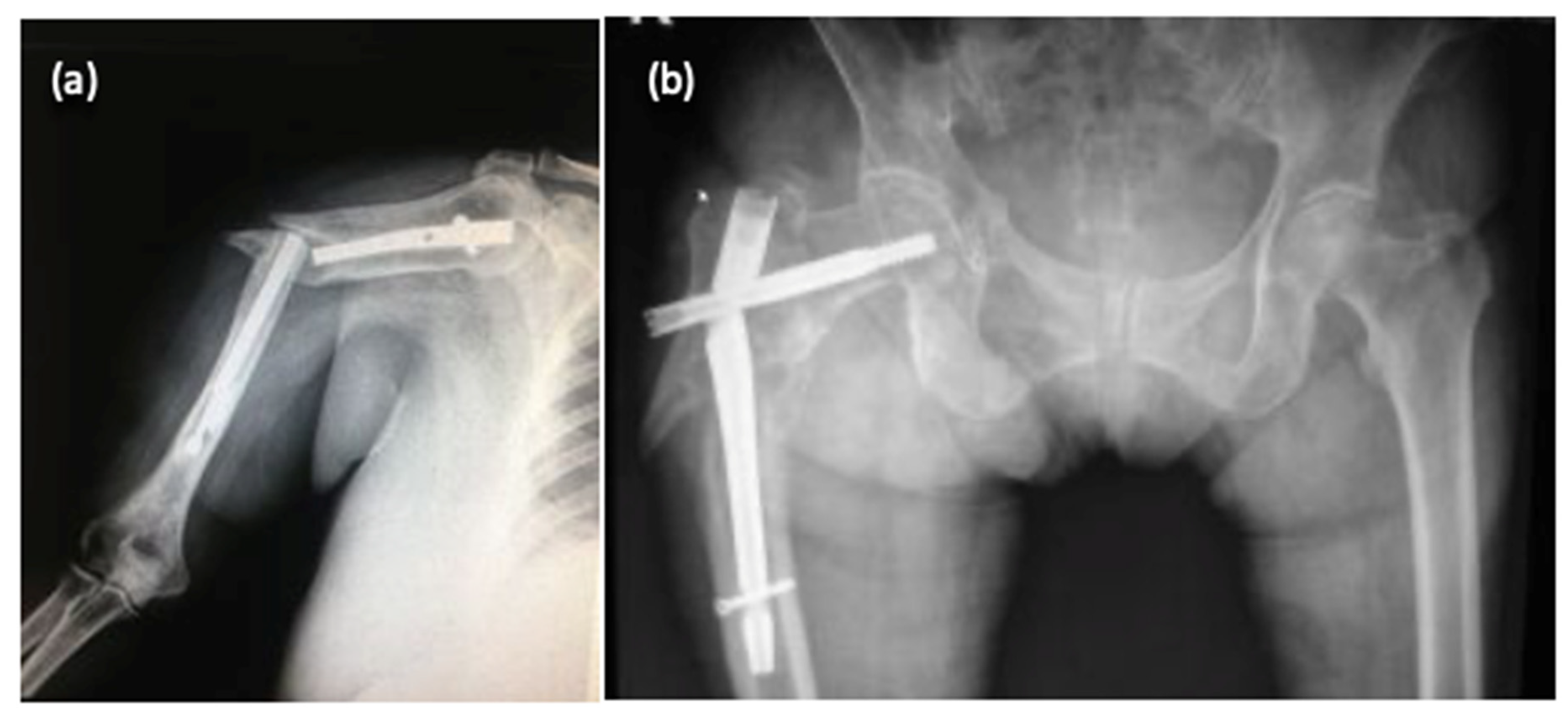 Materials 13 01201 g002