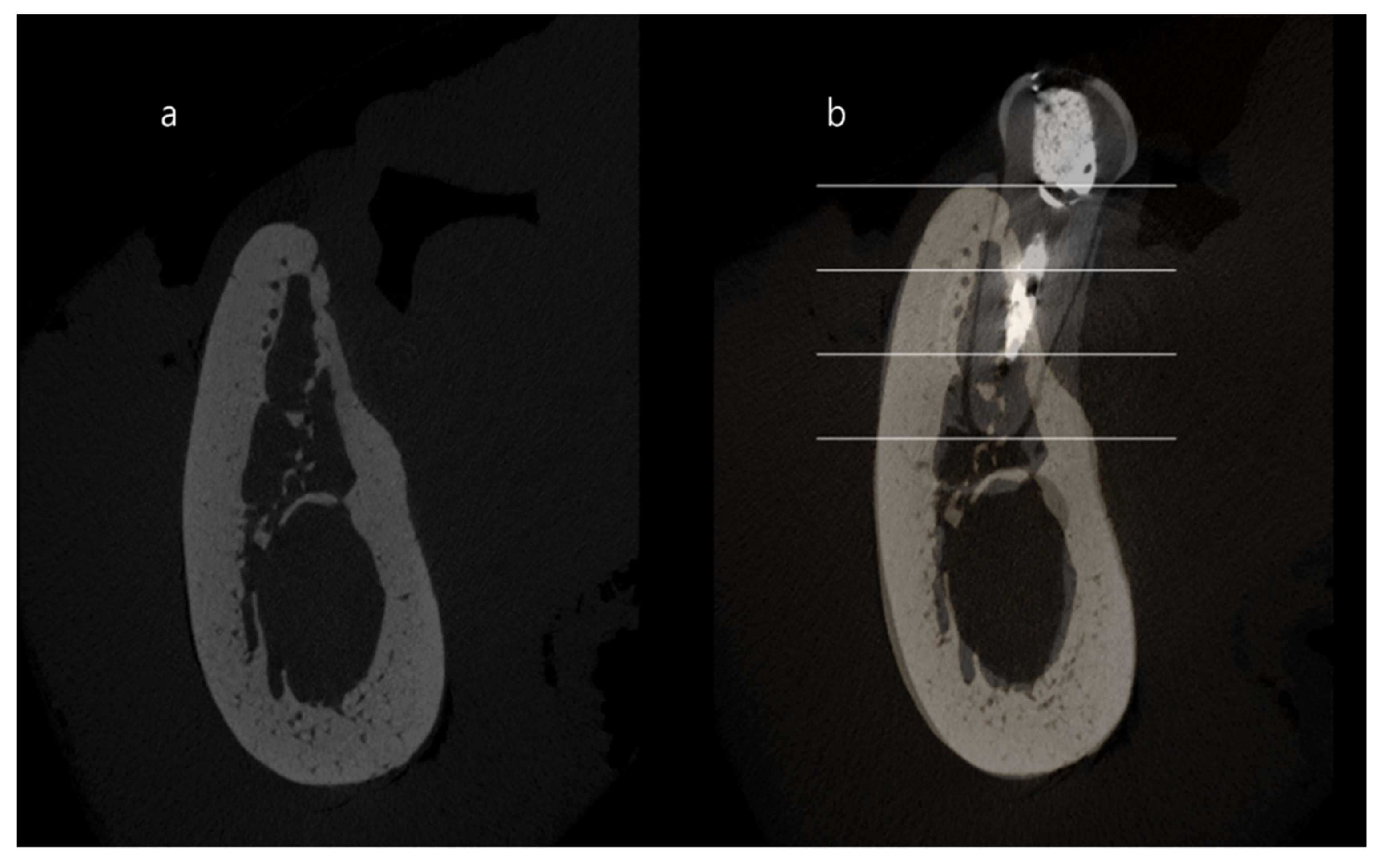 Materials 13 01452 g004