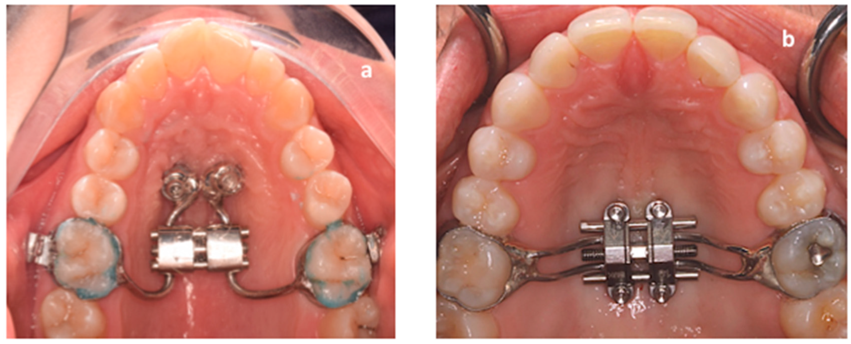 Materials 13 01815 g001