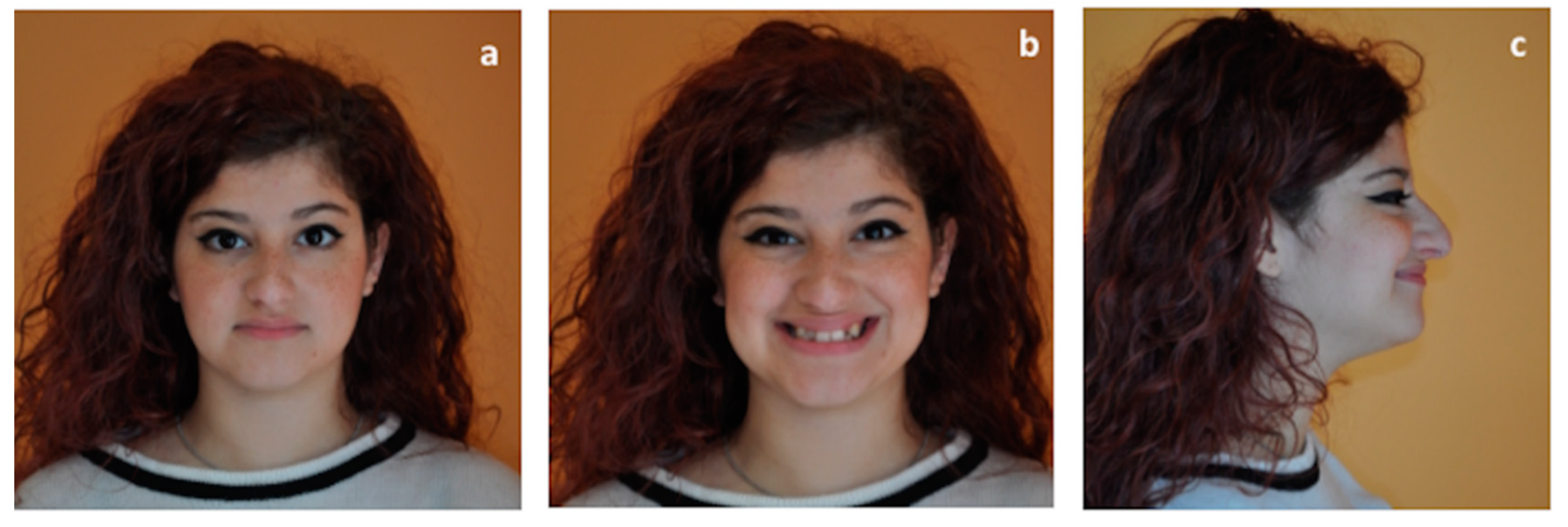 Materials 13 01815 g007