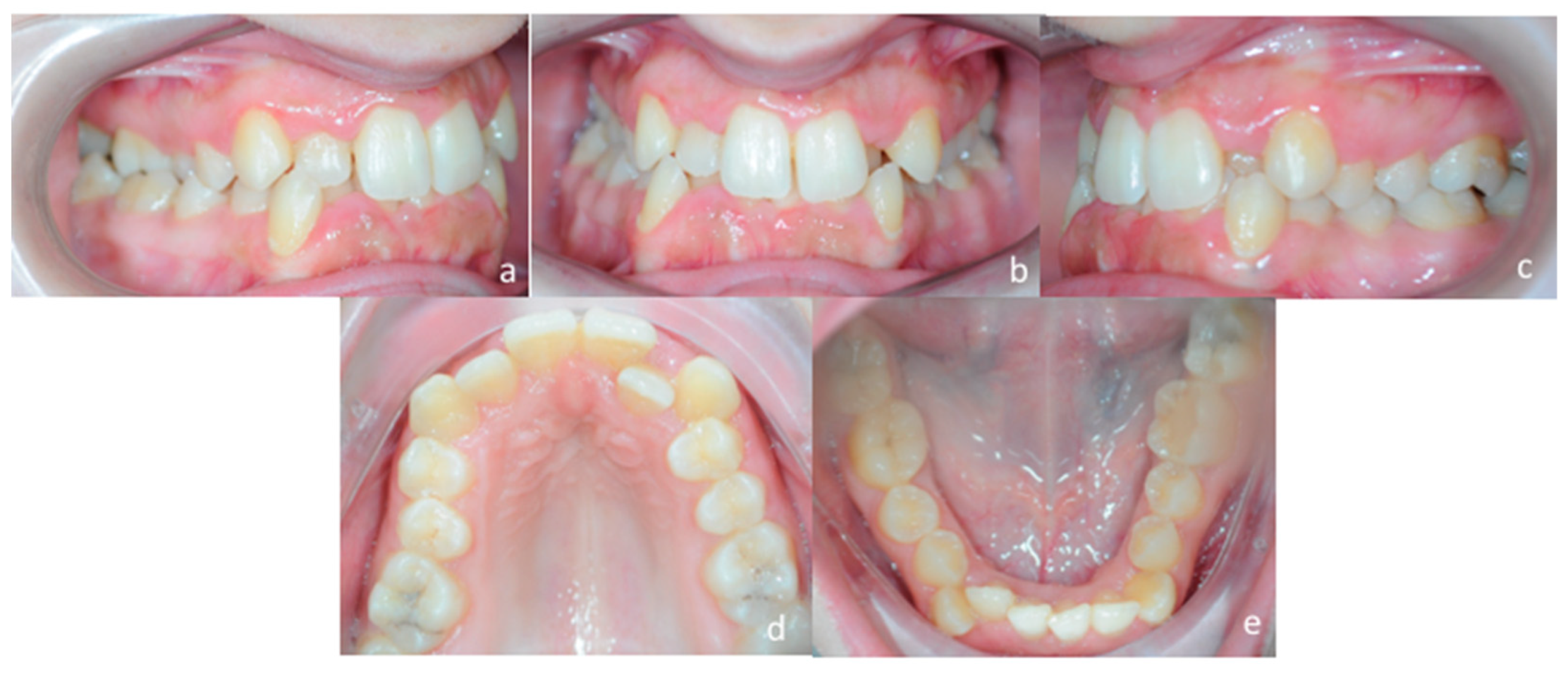 Materials 13 01815 g008