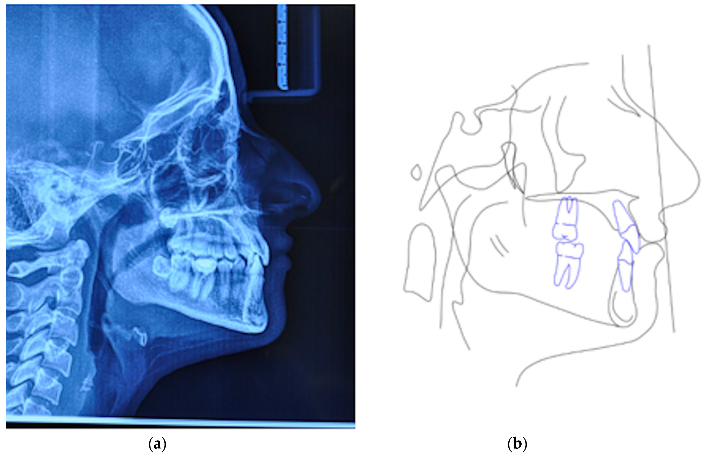 Materials 13 01815 g010