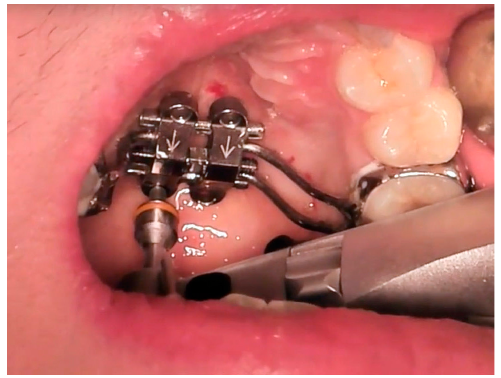 Materials 13 01815 g011