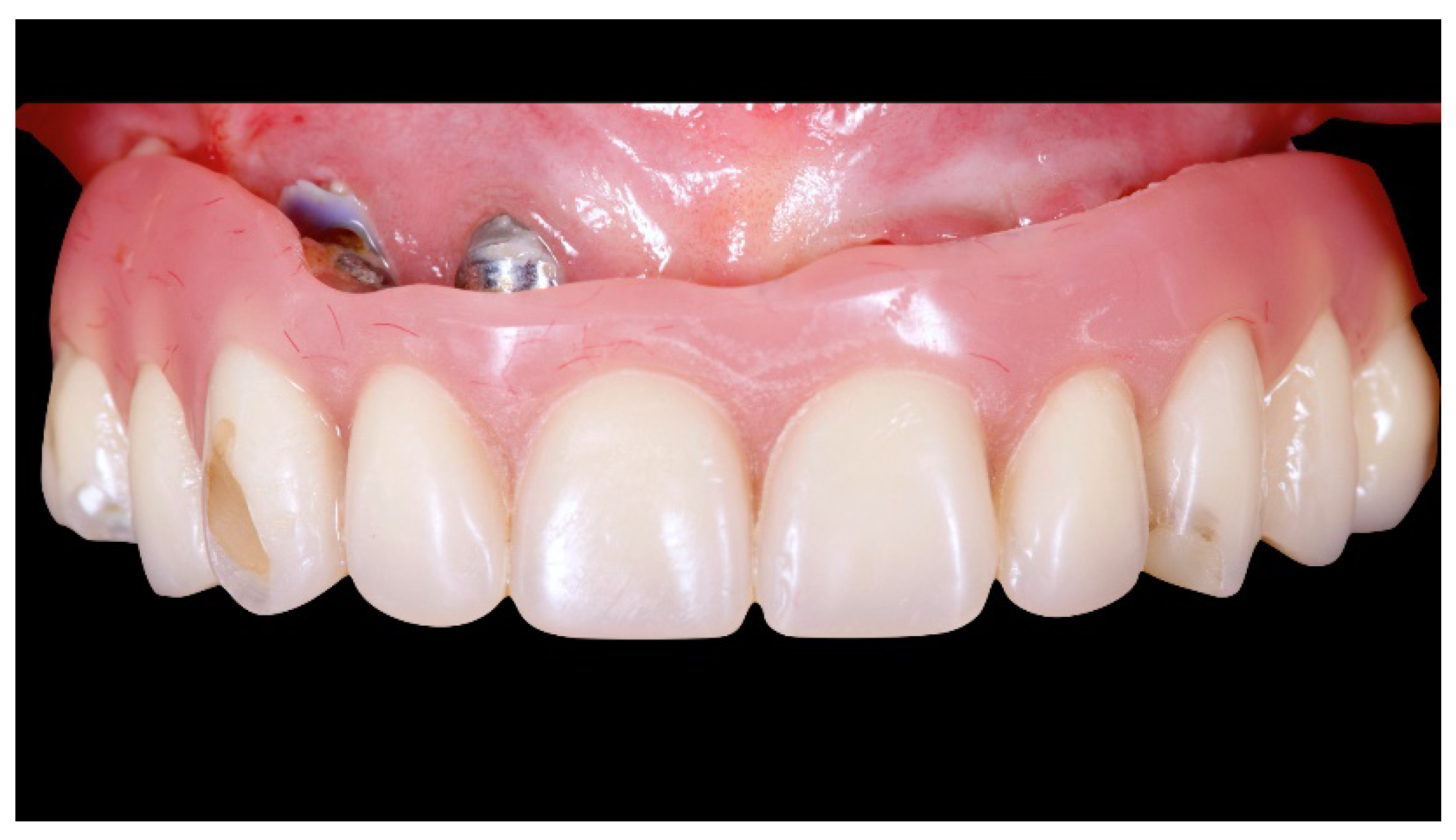 Materials 13 01883 g001