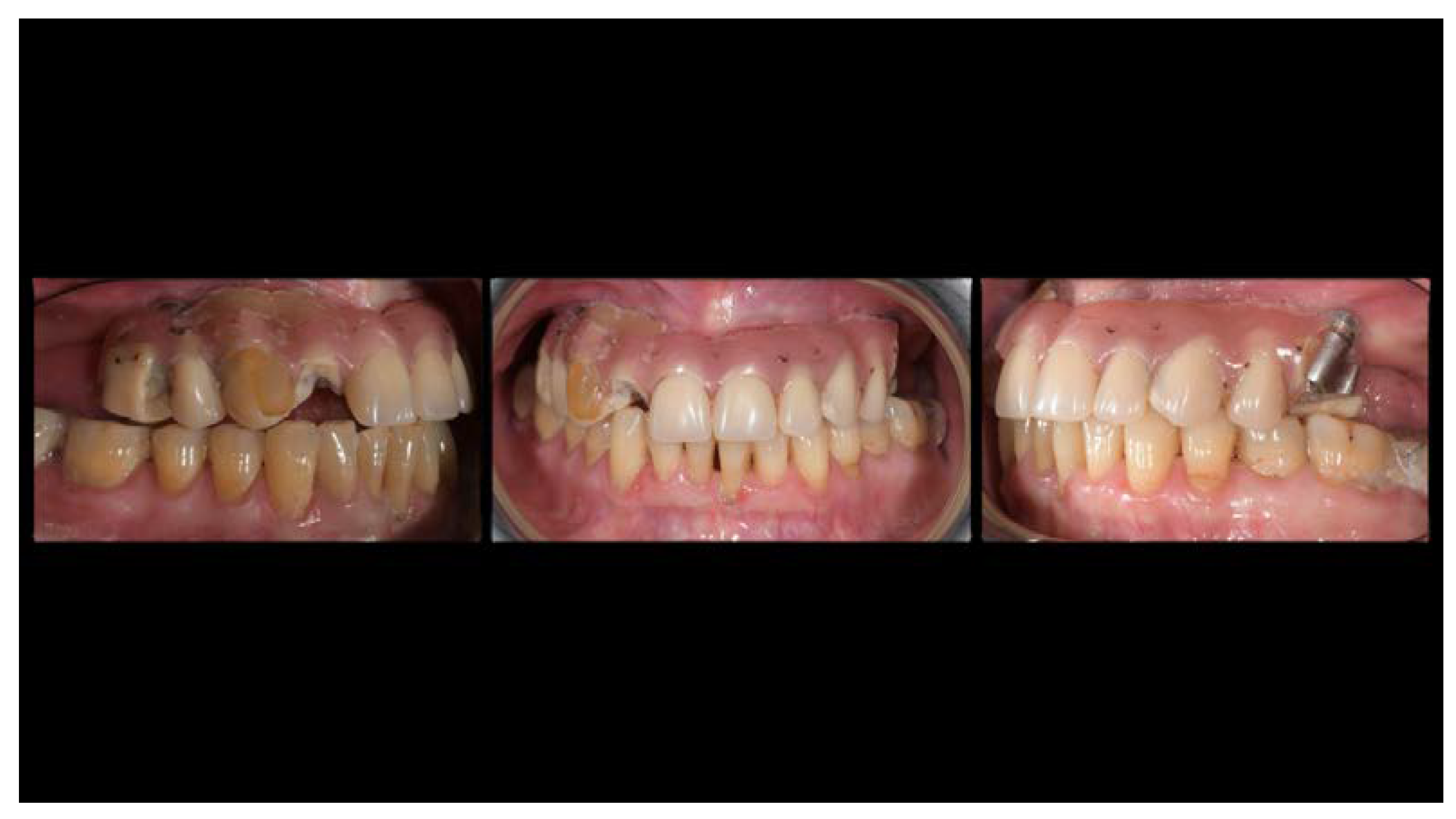 Materials 13 01883 g002