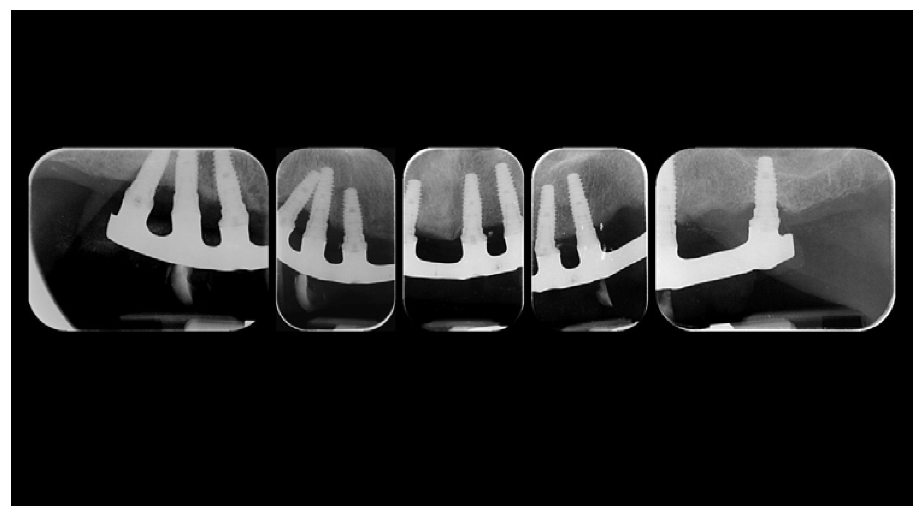 Materials 13 01883 g004