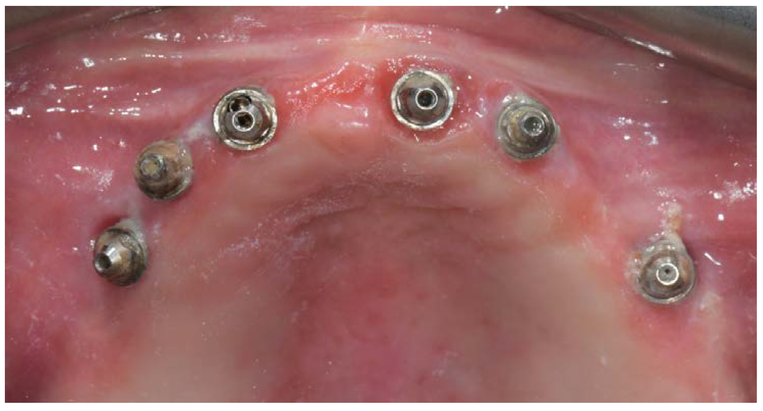 Materials 13 01883 g005