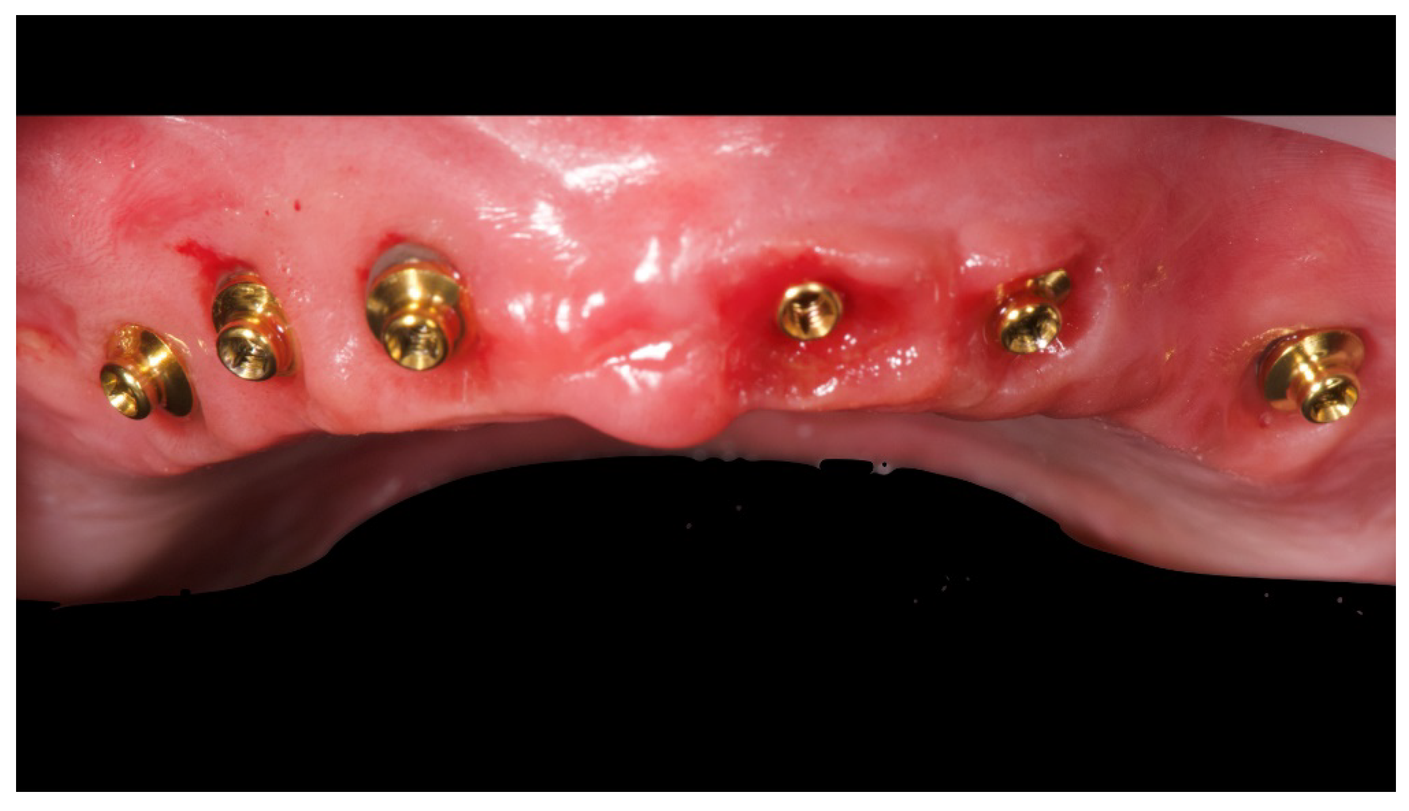 Materials 13 01883 g006