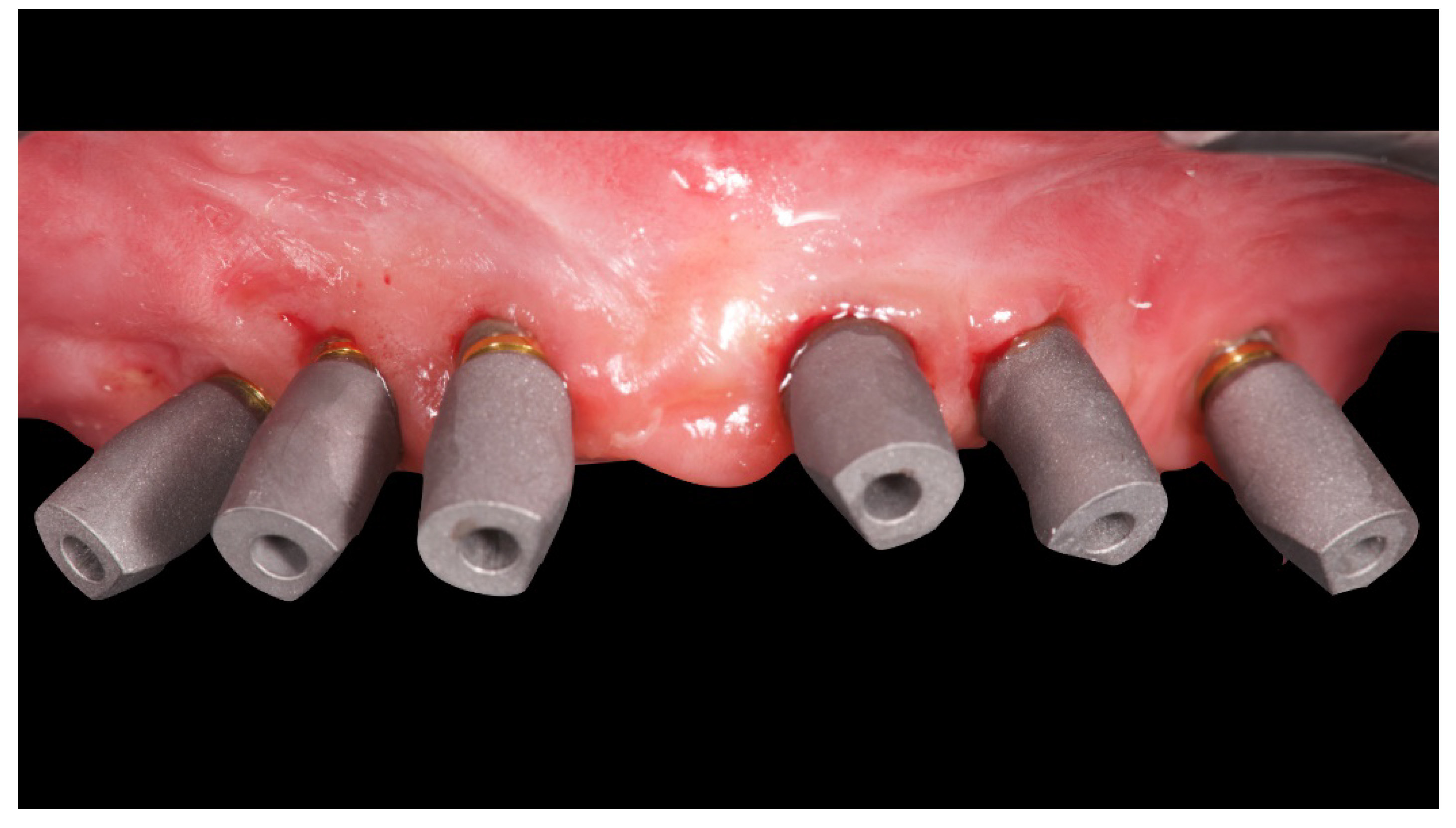 Materials 13 01883 g007