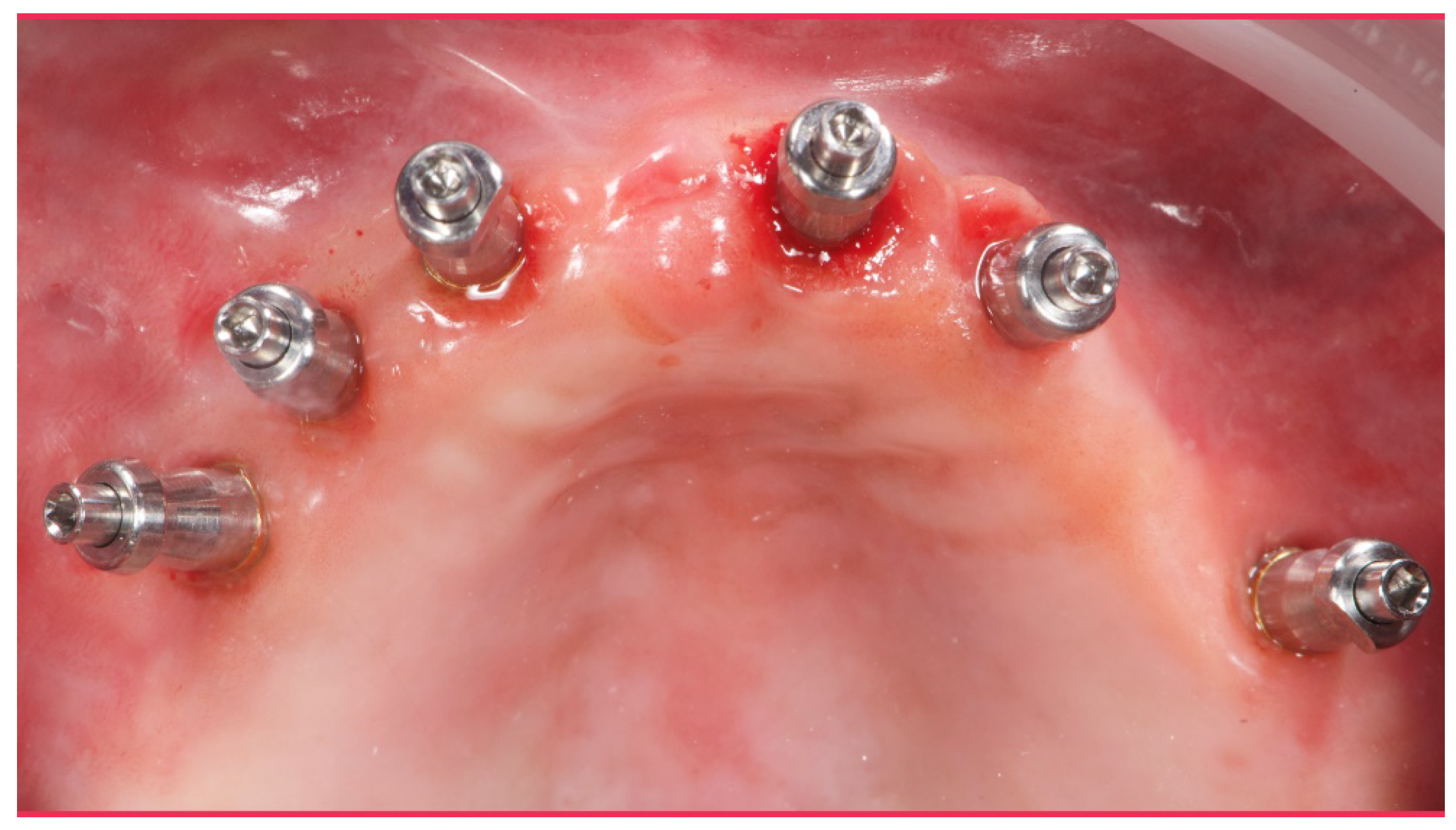 Materials 13 01883 g008