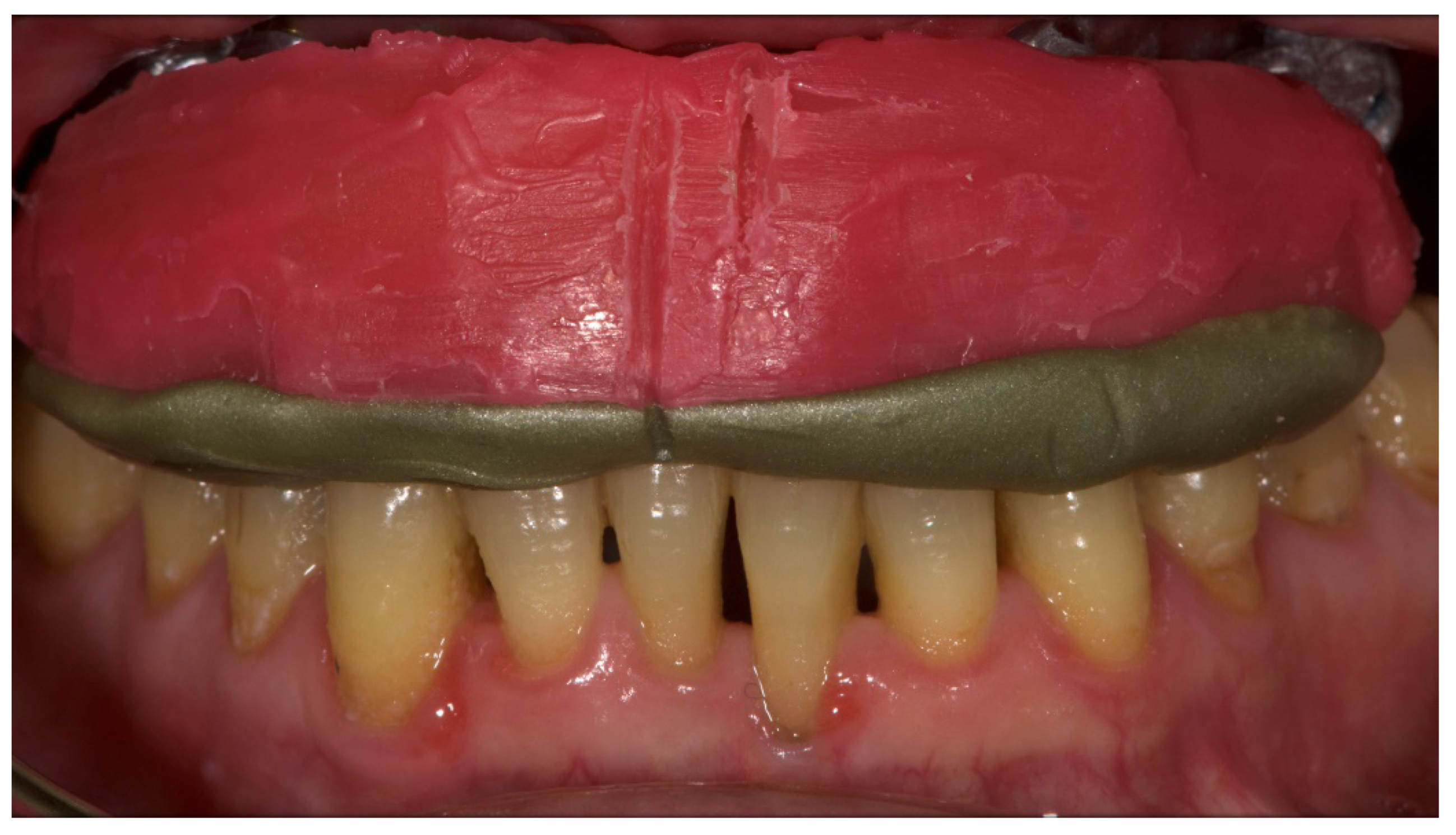 Materials 13 01883 g010