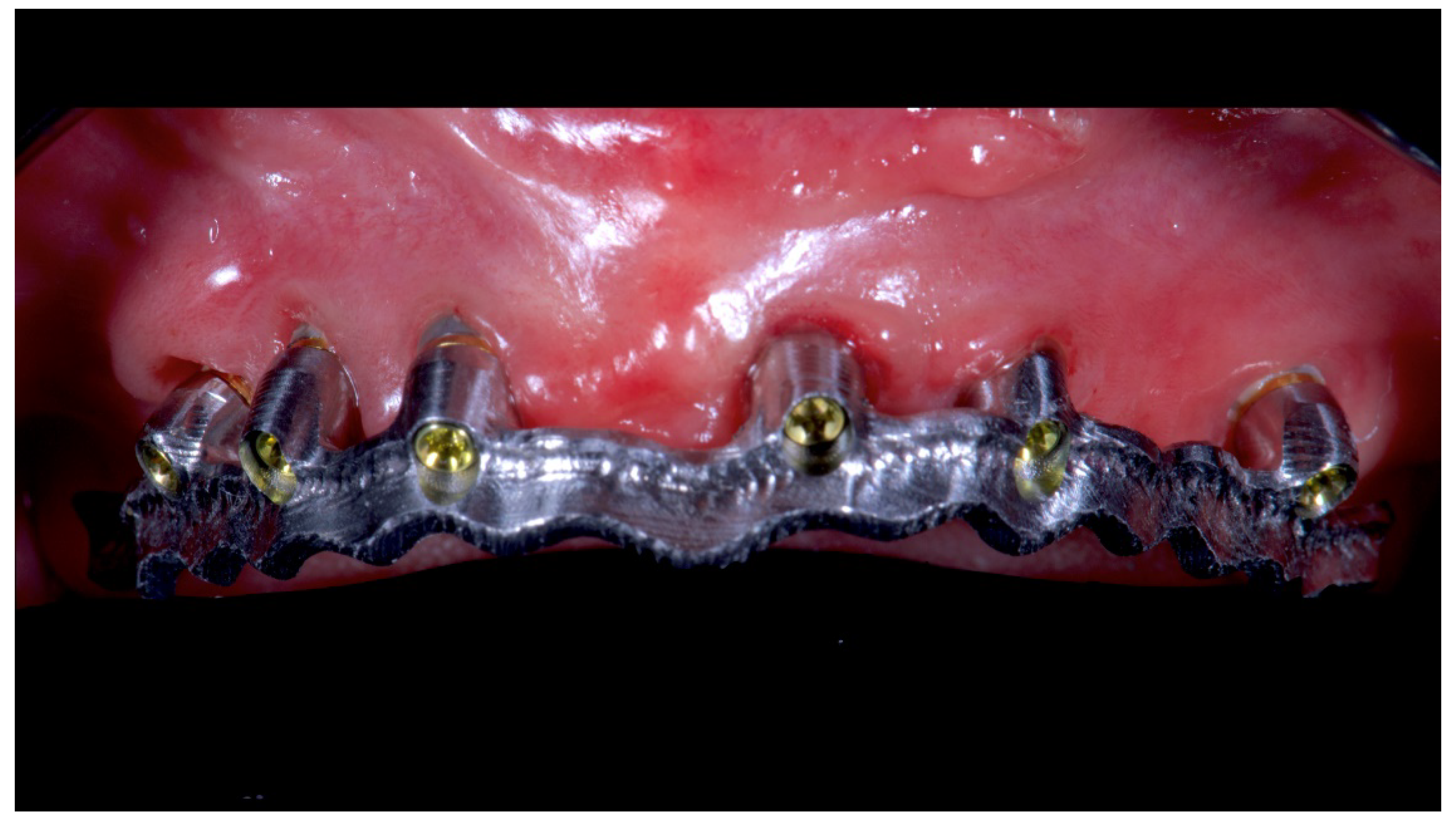 Materials 13 01883 g012