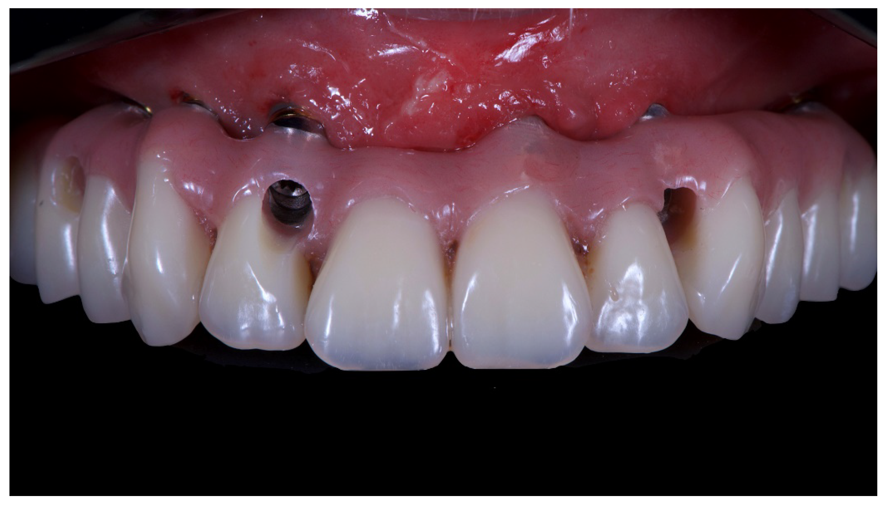 Materials 13 01883 g013