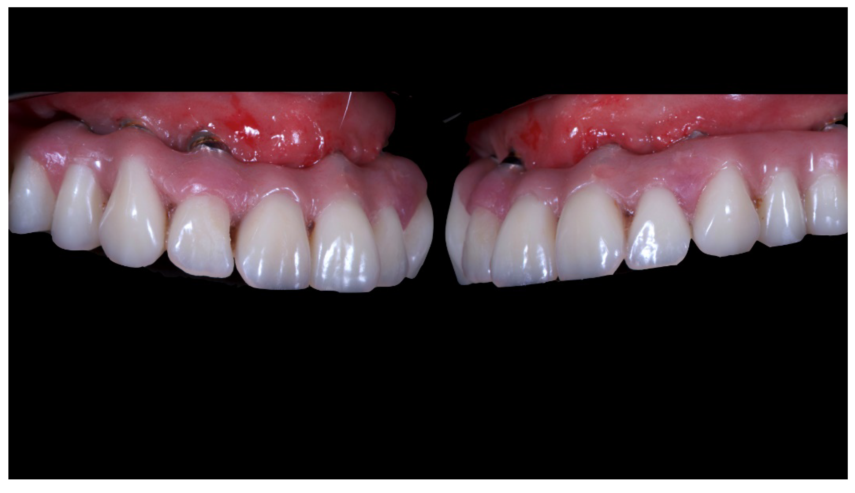 Materials 13 01883 g014