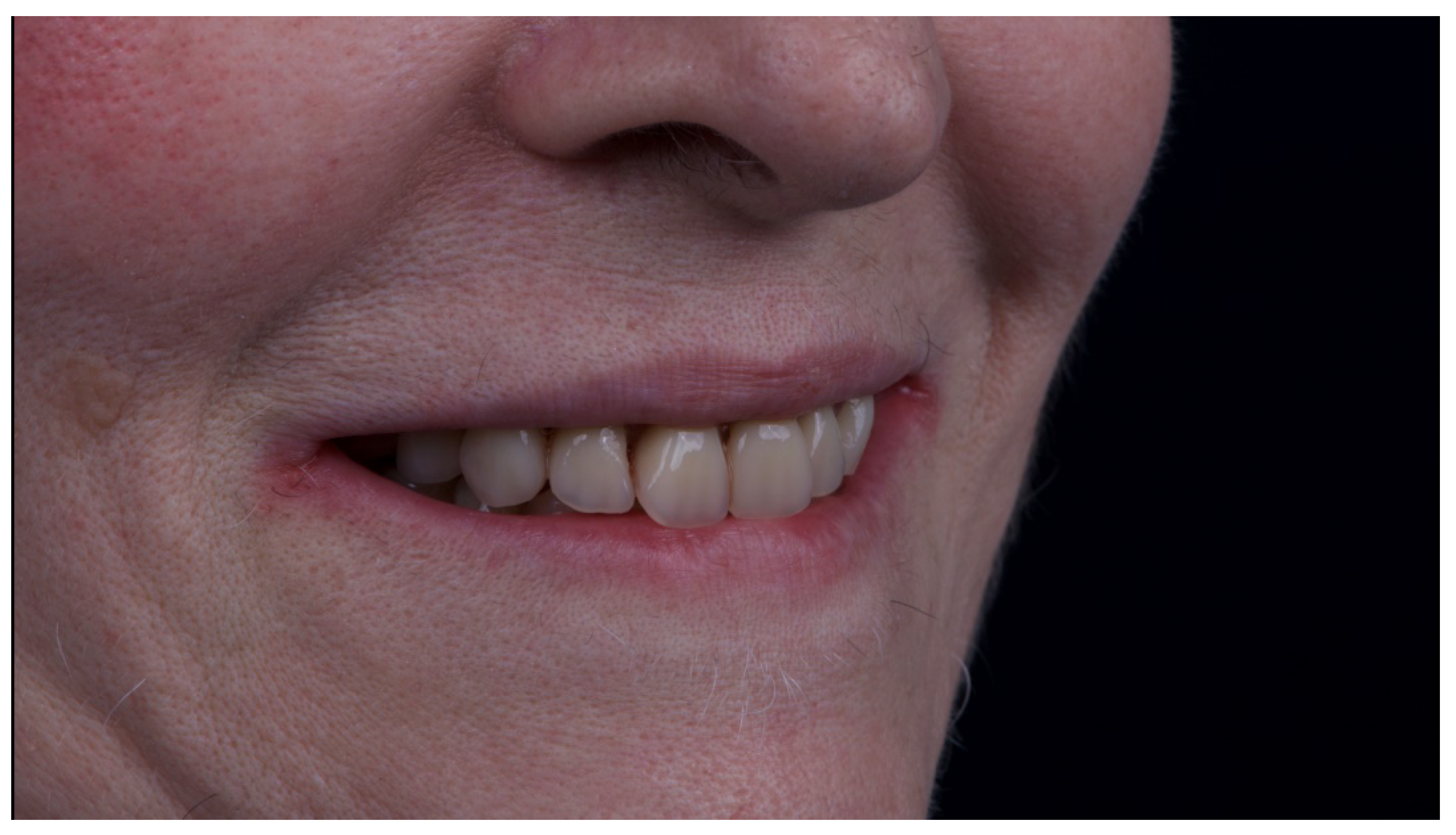 Materials 13 01883 g015