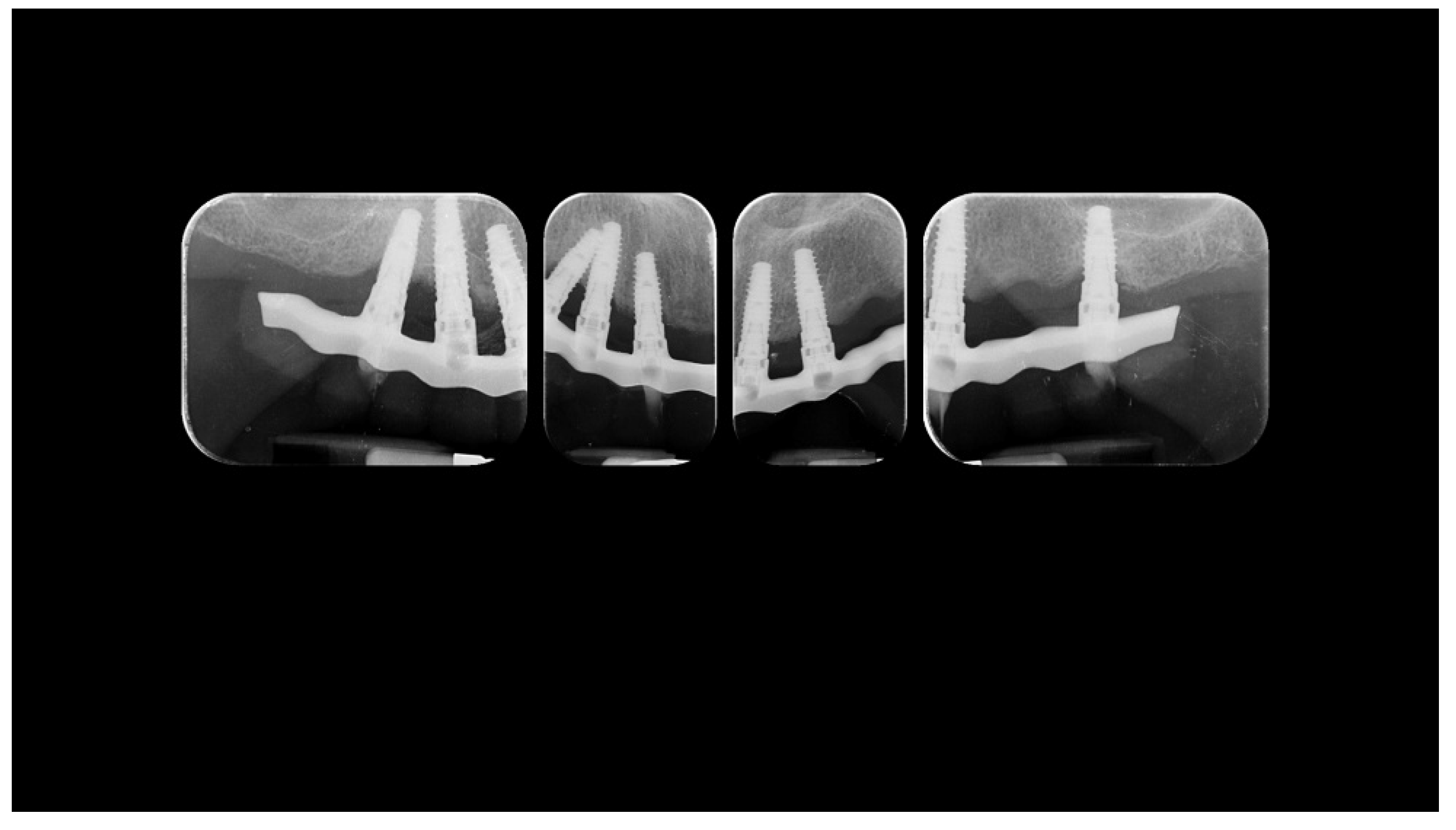 Materials 13 01883 g016