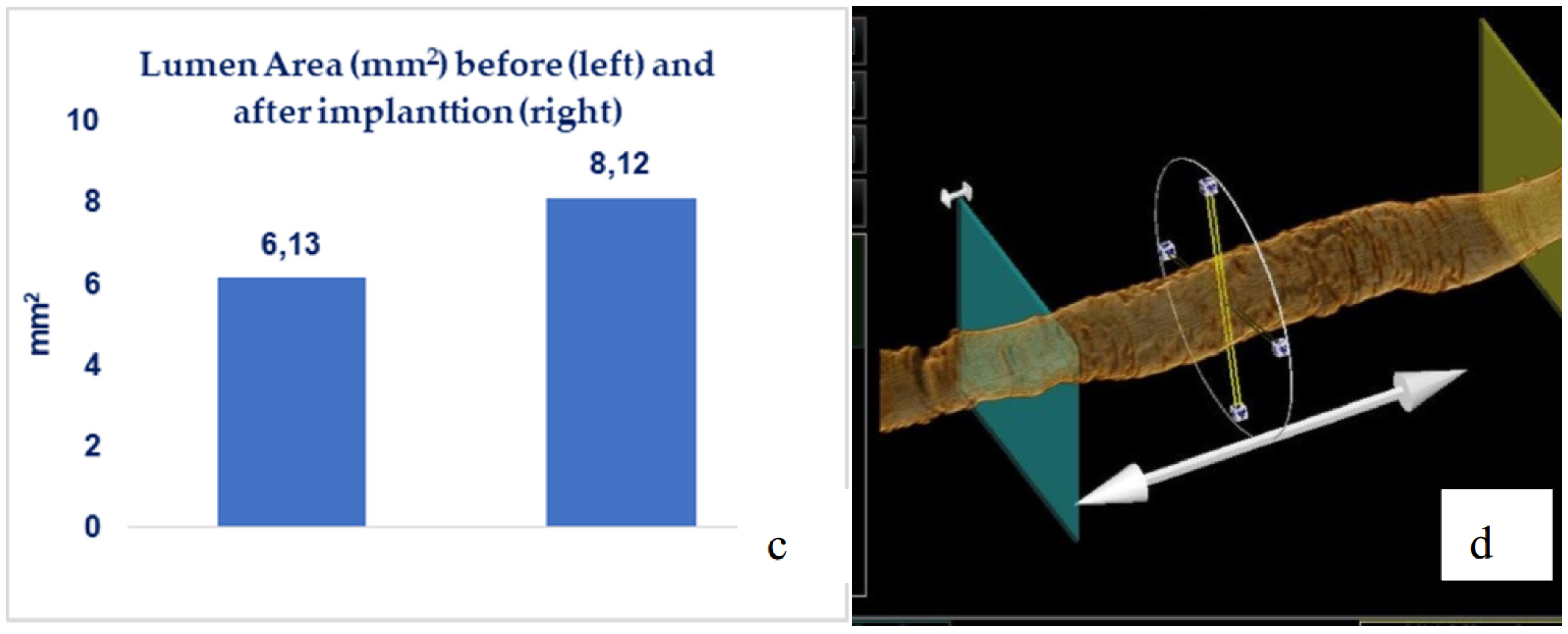Materials 13 02003 g013b