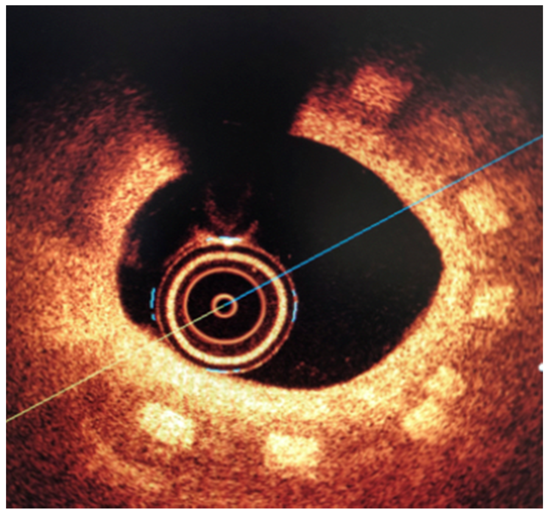 Materials 13 02003 g014