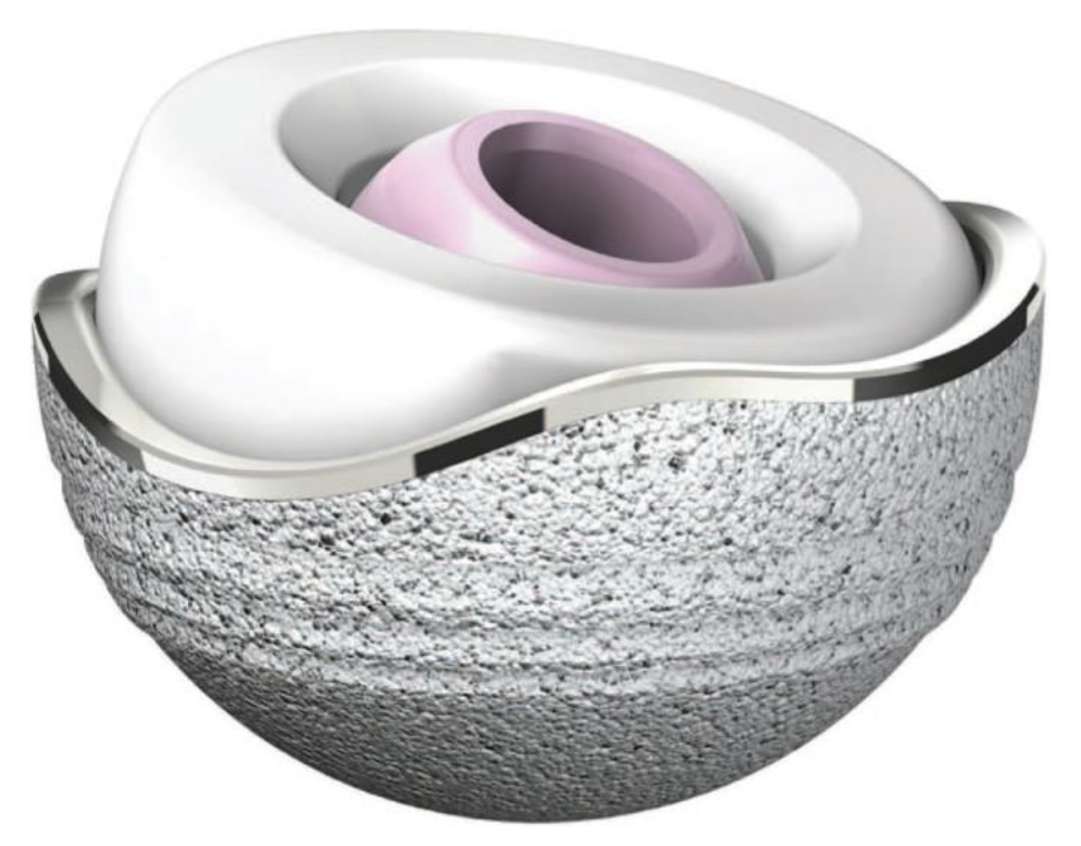 Materials 13 02040 g005