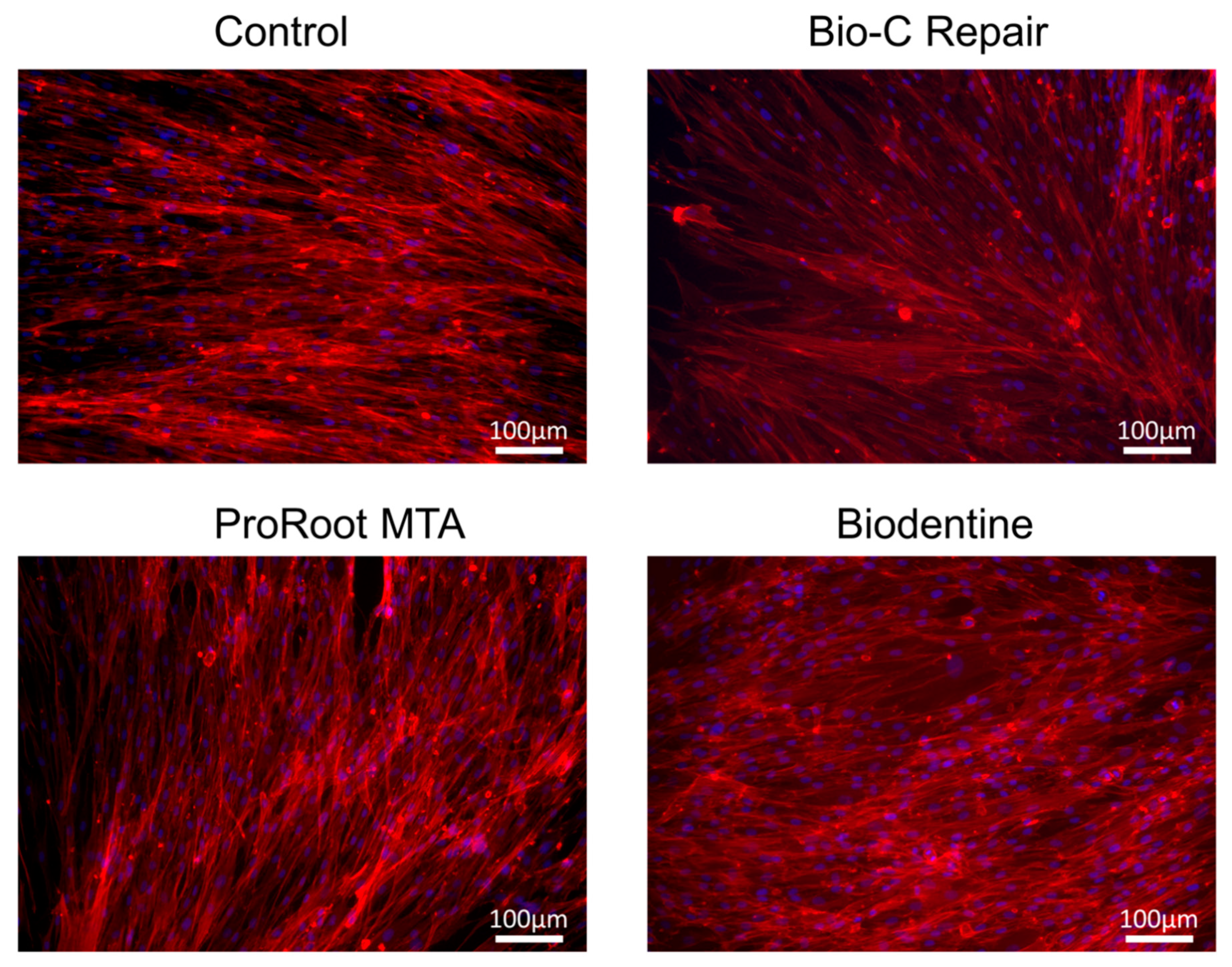 Materials 13 02189 g005