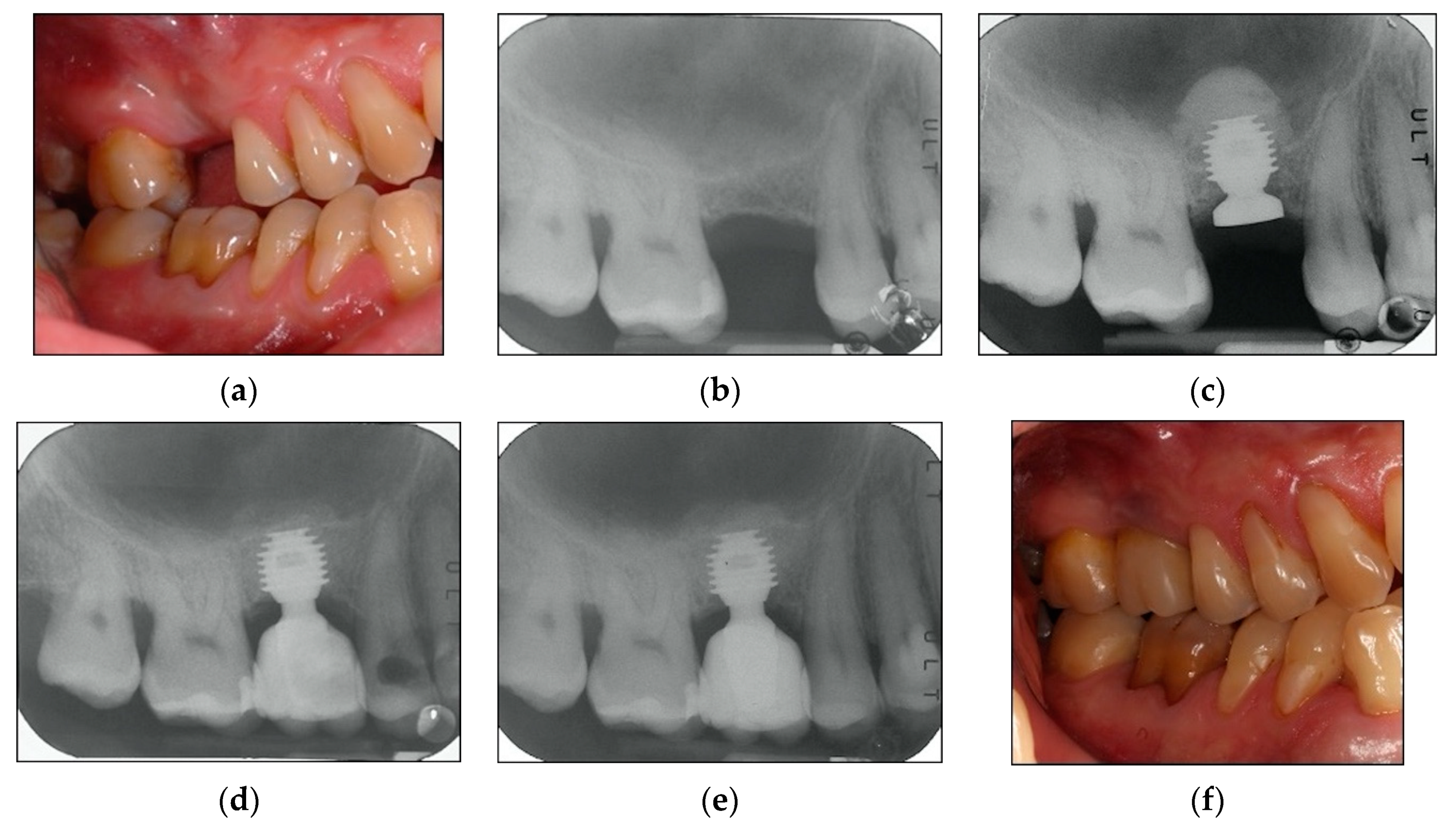 Materials 13 02208 g002
