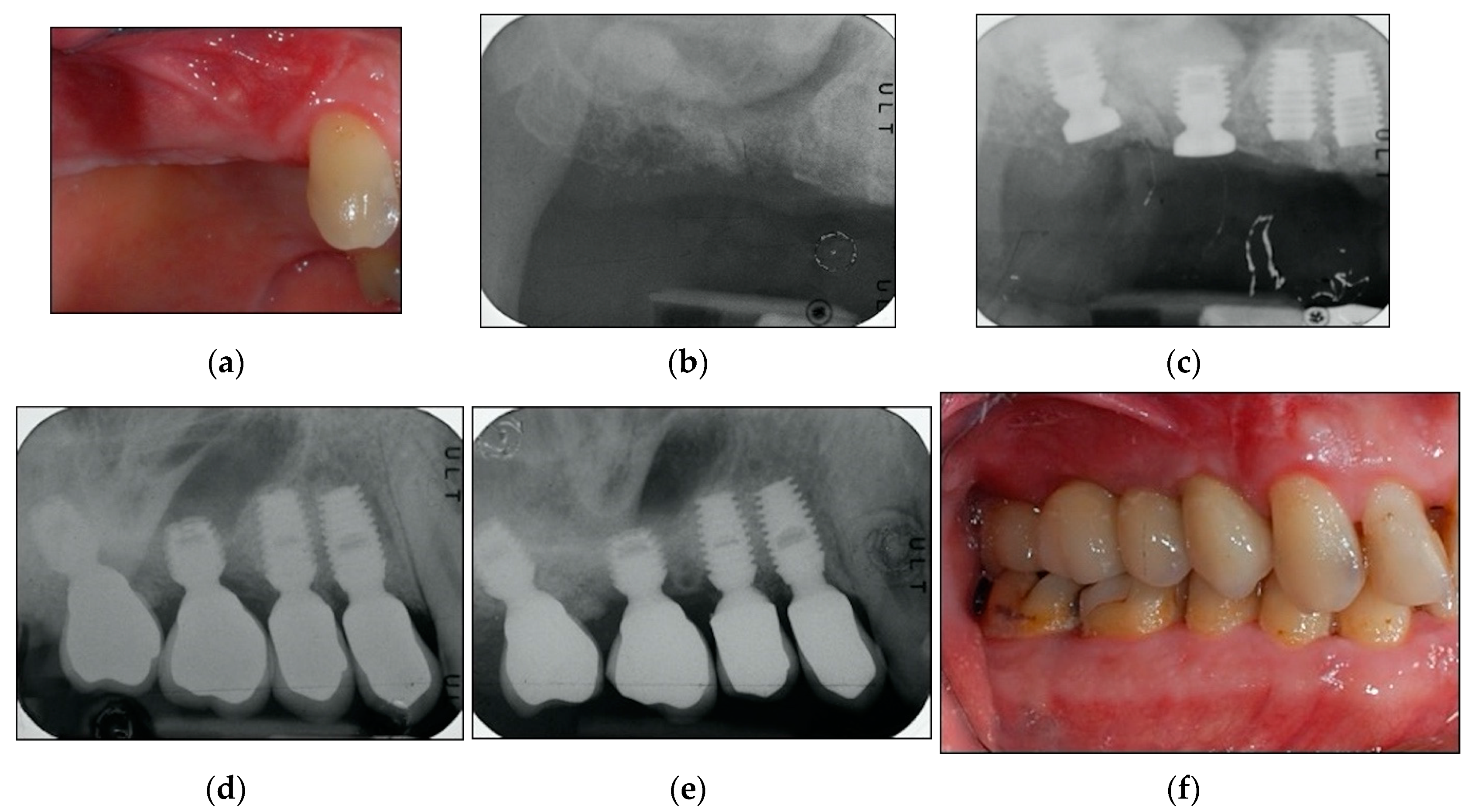 Materials 13 02208 g003