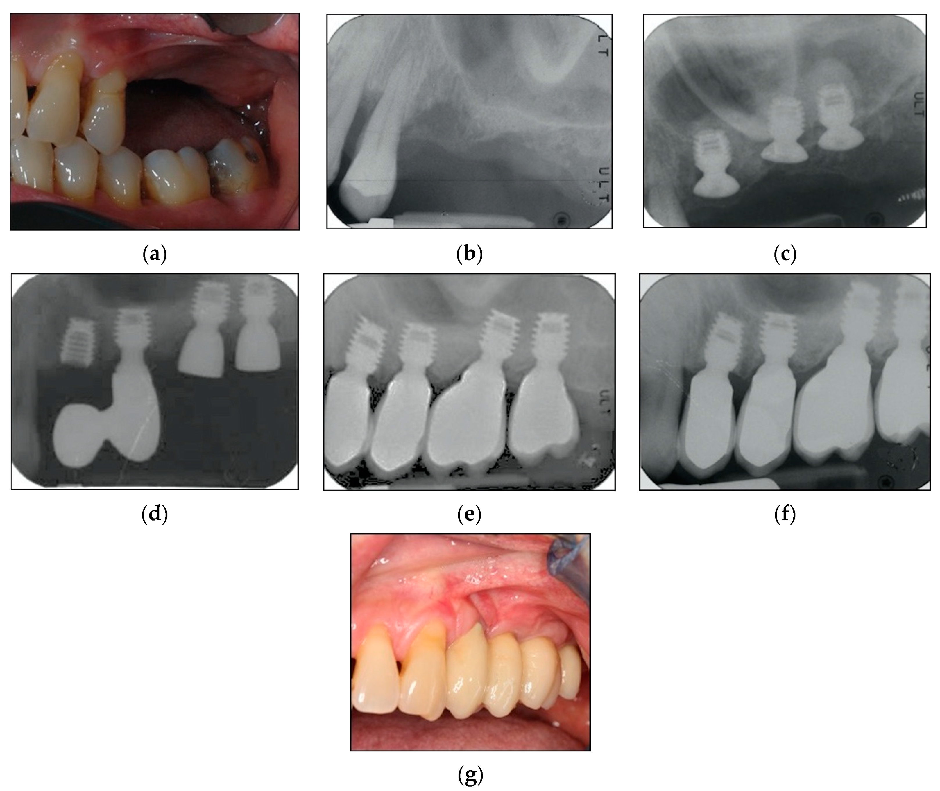 Materials 13 02208 g004