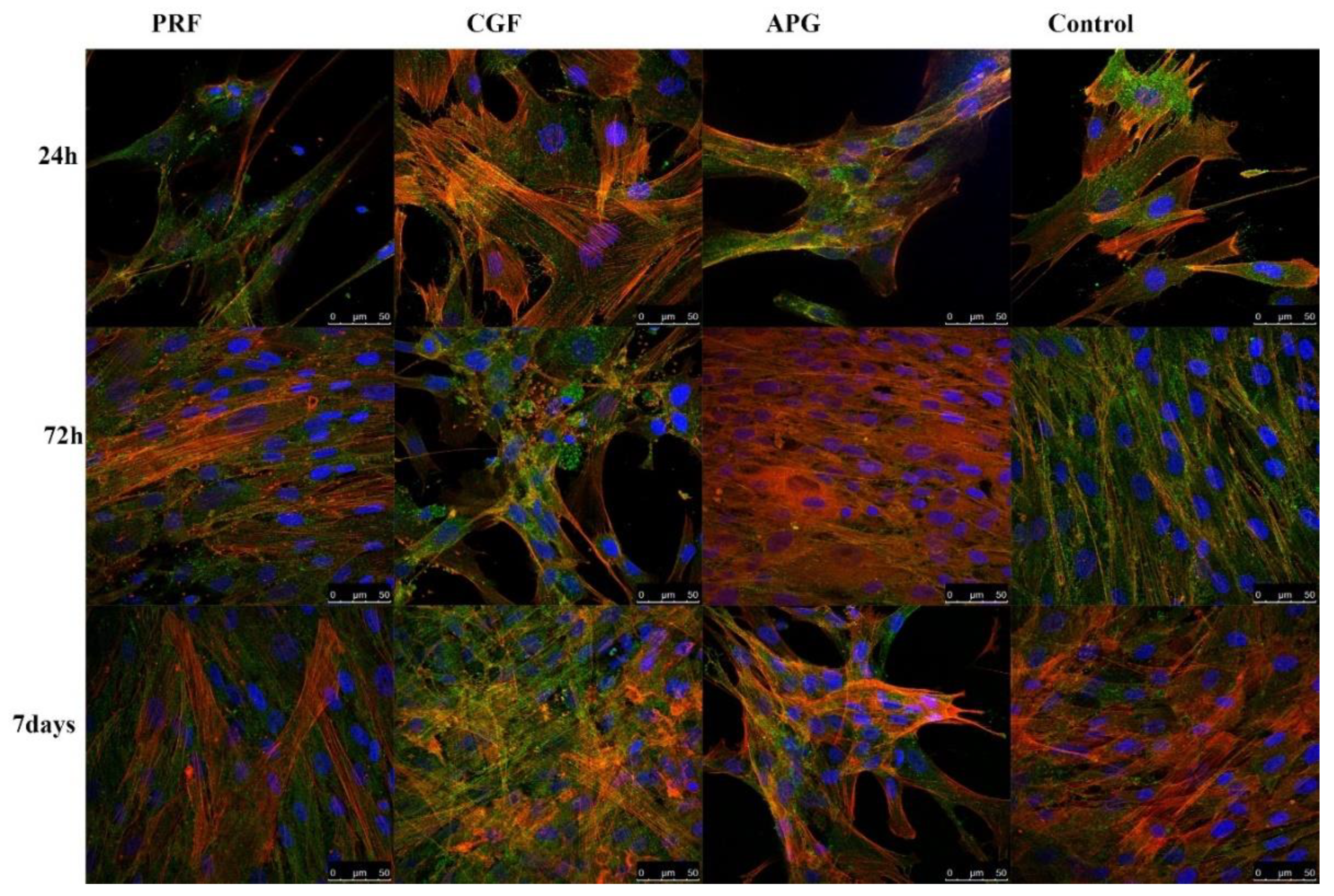 Materials 13 02282 g004