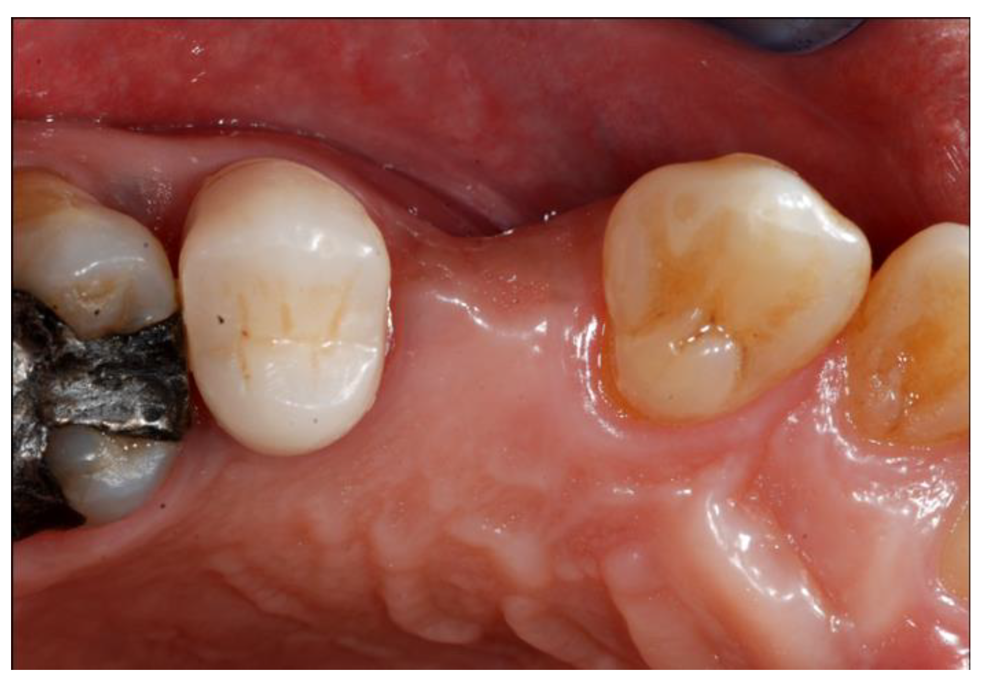 Materials 13 02389 g001