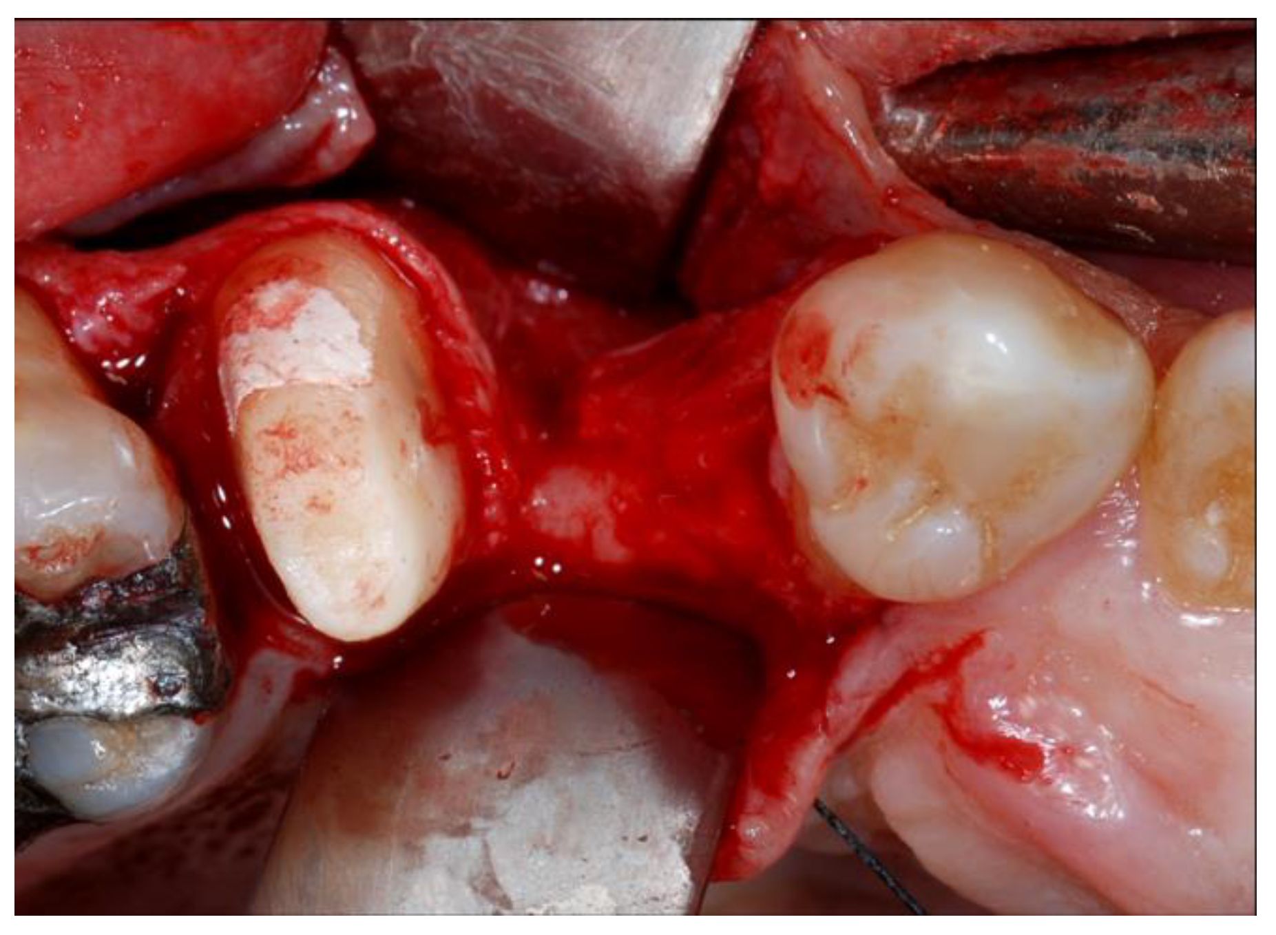 Materials 13 02389 g002